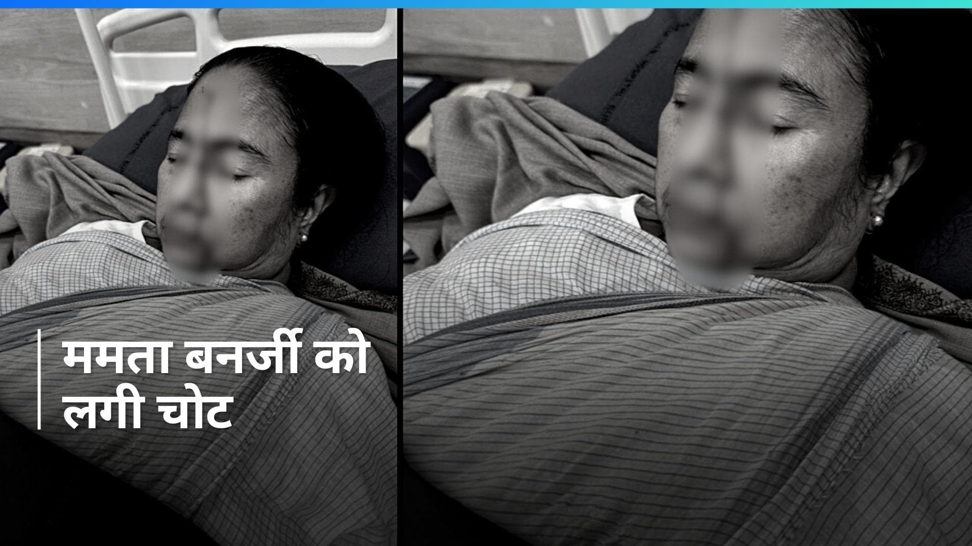 Mamata Banerjee injured: ममता बनर्जी के माथे पर लगी गंभीर चोट, अस्पताल में भर्ती, TMC ने की ये अपील