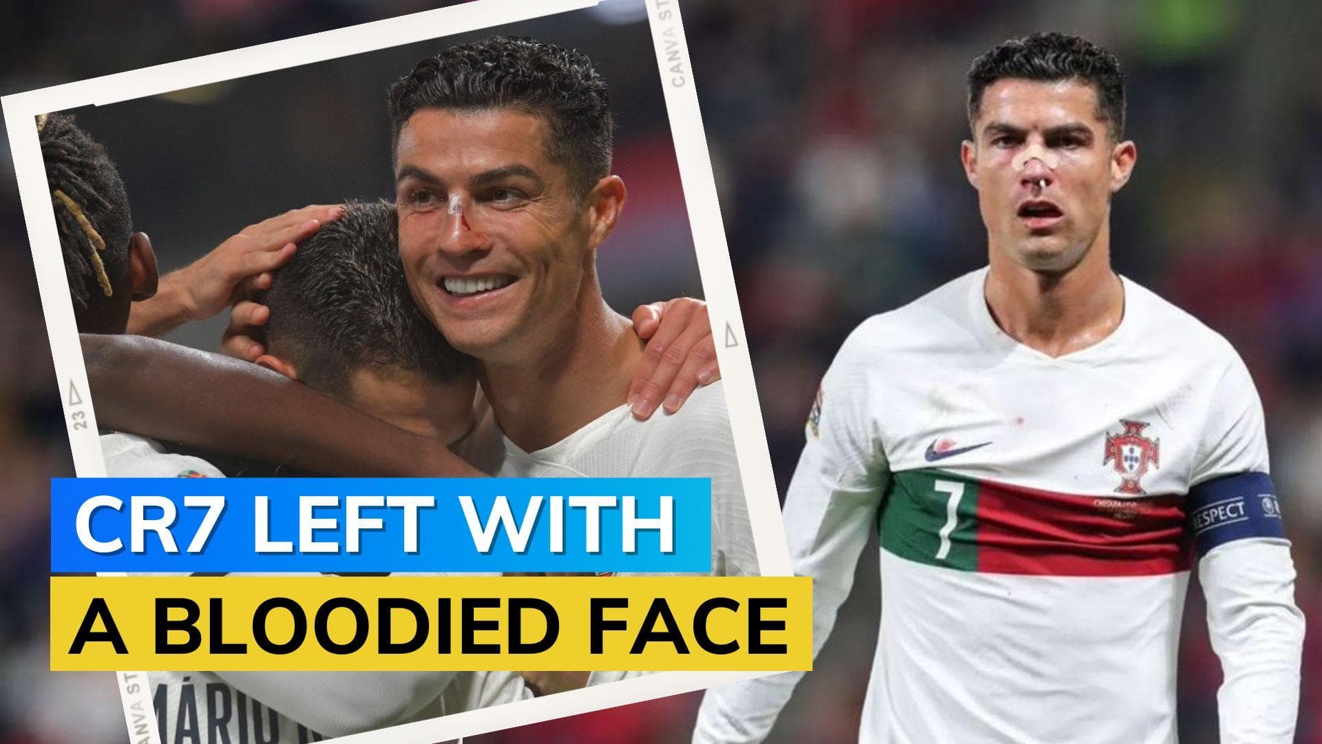 Nations League: Cristiano Ronaldo suffers injury as Portugal beat Czech Republic 4-0