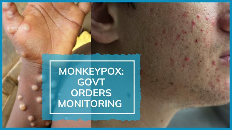India issues guidelines as more countries report Monkeypox cases