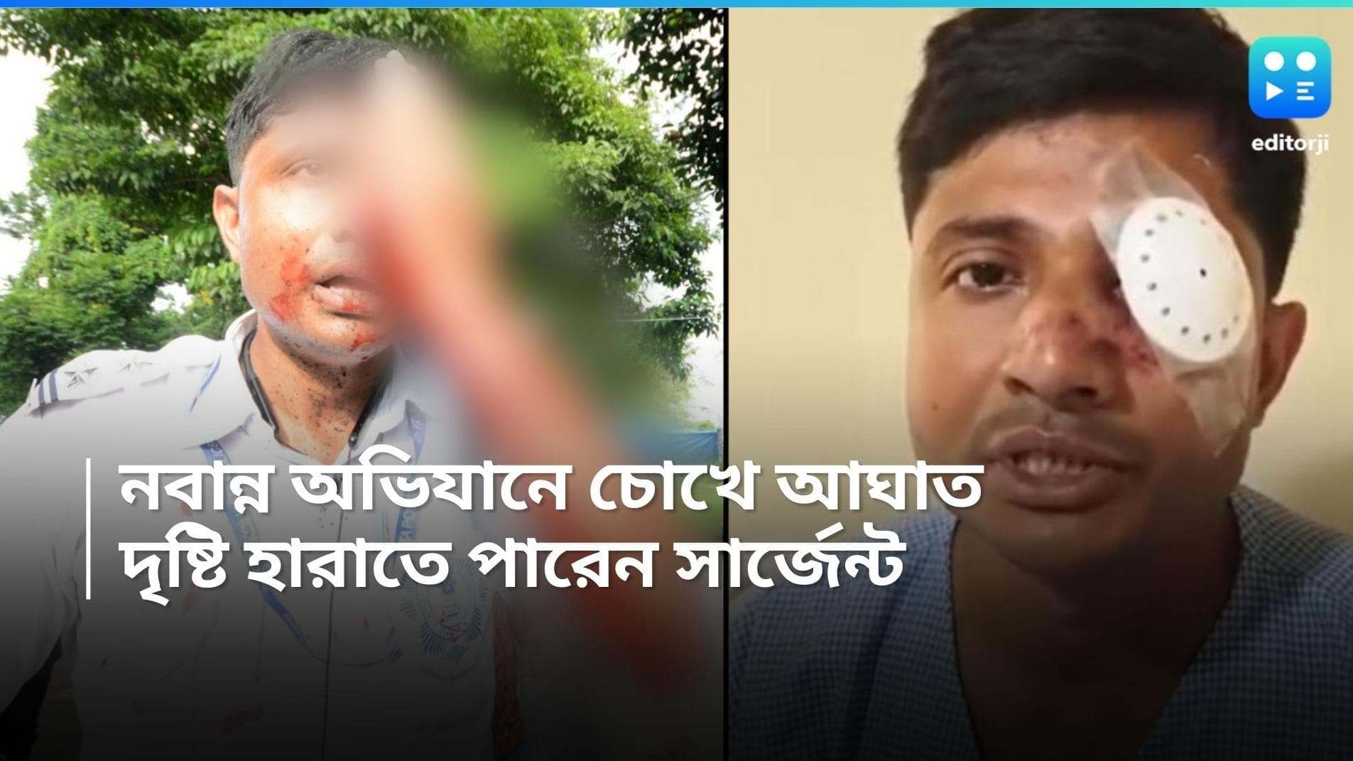 Nabanna Abhijan: নবান্ন অভিযানে ইটের আঘাত, দৃষ্টি হারাতে পারেন কলকাতা পুলিশ সার্জেন্ট 