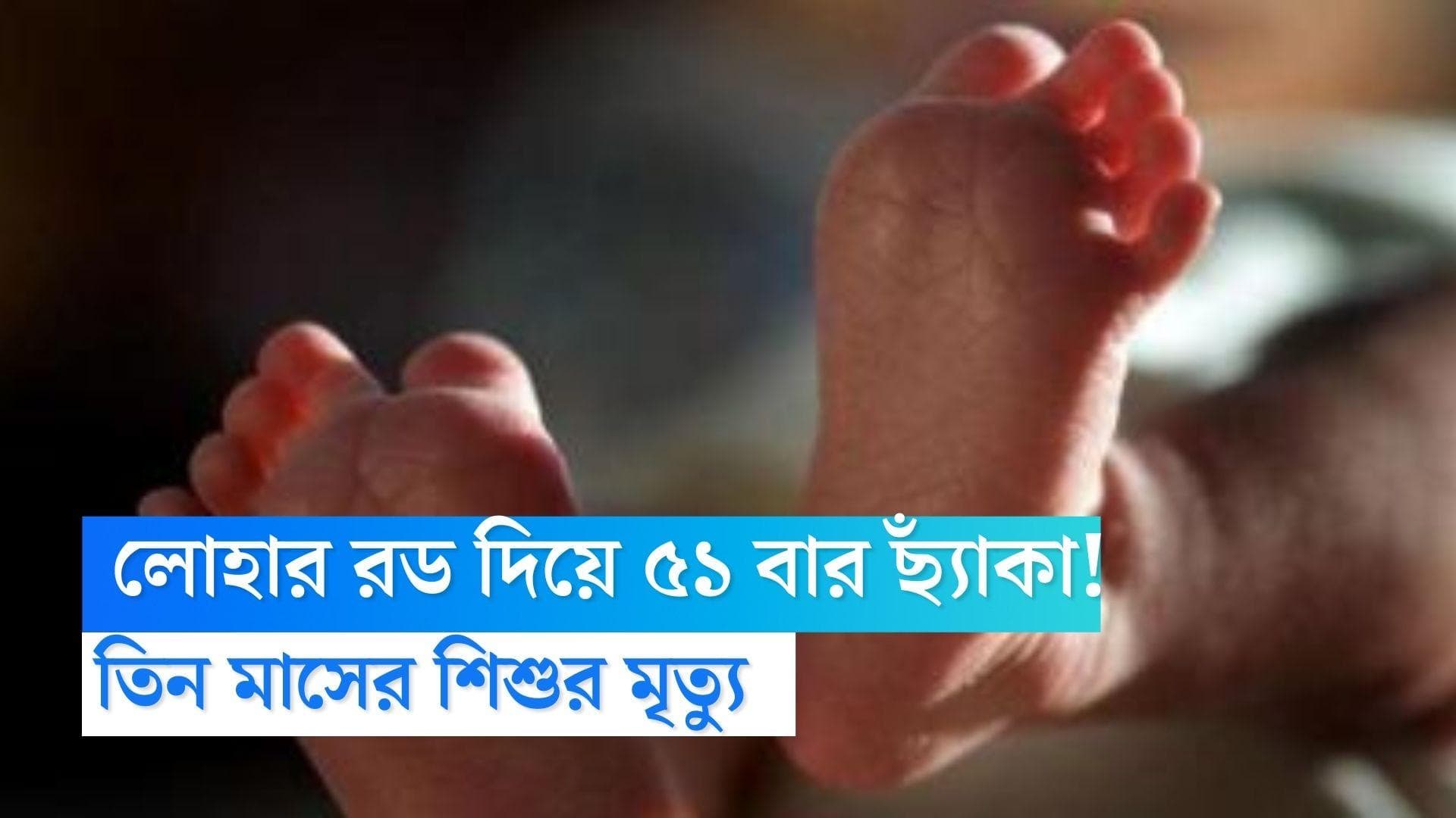 MP Infant Death: নিউমোনিয়া সারাতে ৫১ বার লোহার রডের ছ্যাঁকা! মধ্যপ্রদেশে ভয়াবহ মৃত্যু তিন মাসের শিশুর