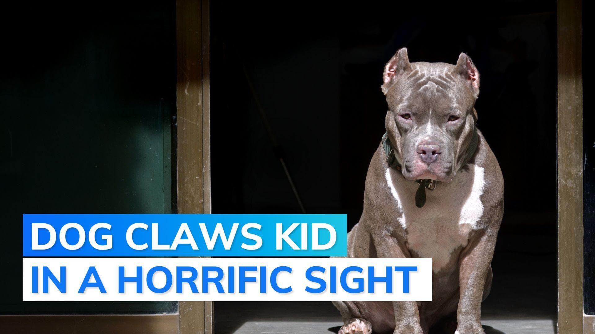 11-year-old boy attacked by pet Pitbull in Ghaziabad, receives 150 stitches in face 