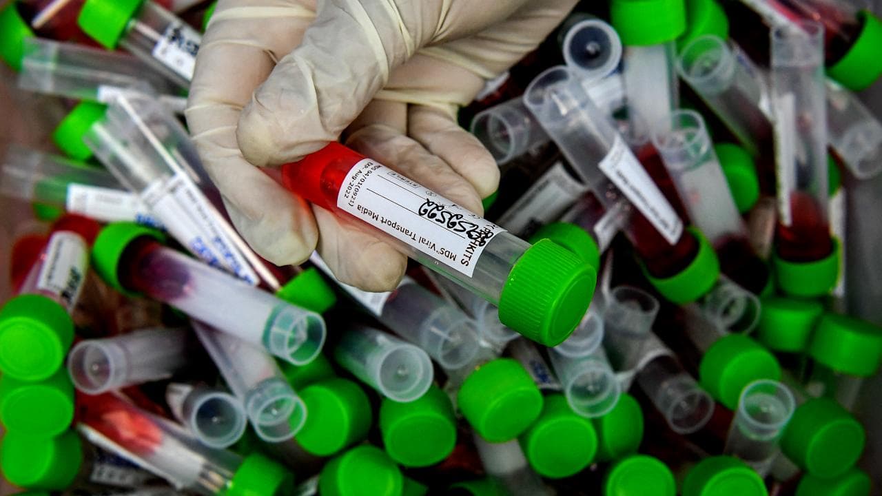 India Covid Update : দেশে গত ২৪ ঘণ্টায় কোভিডে আক্রান্ত হলেন ৬,৫৬৩ জন, মৃত ১৩২