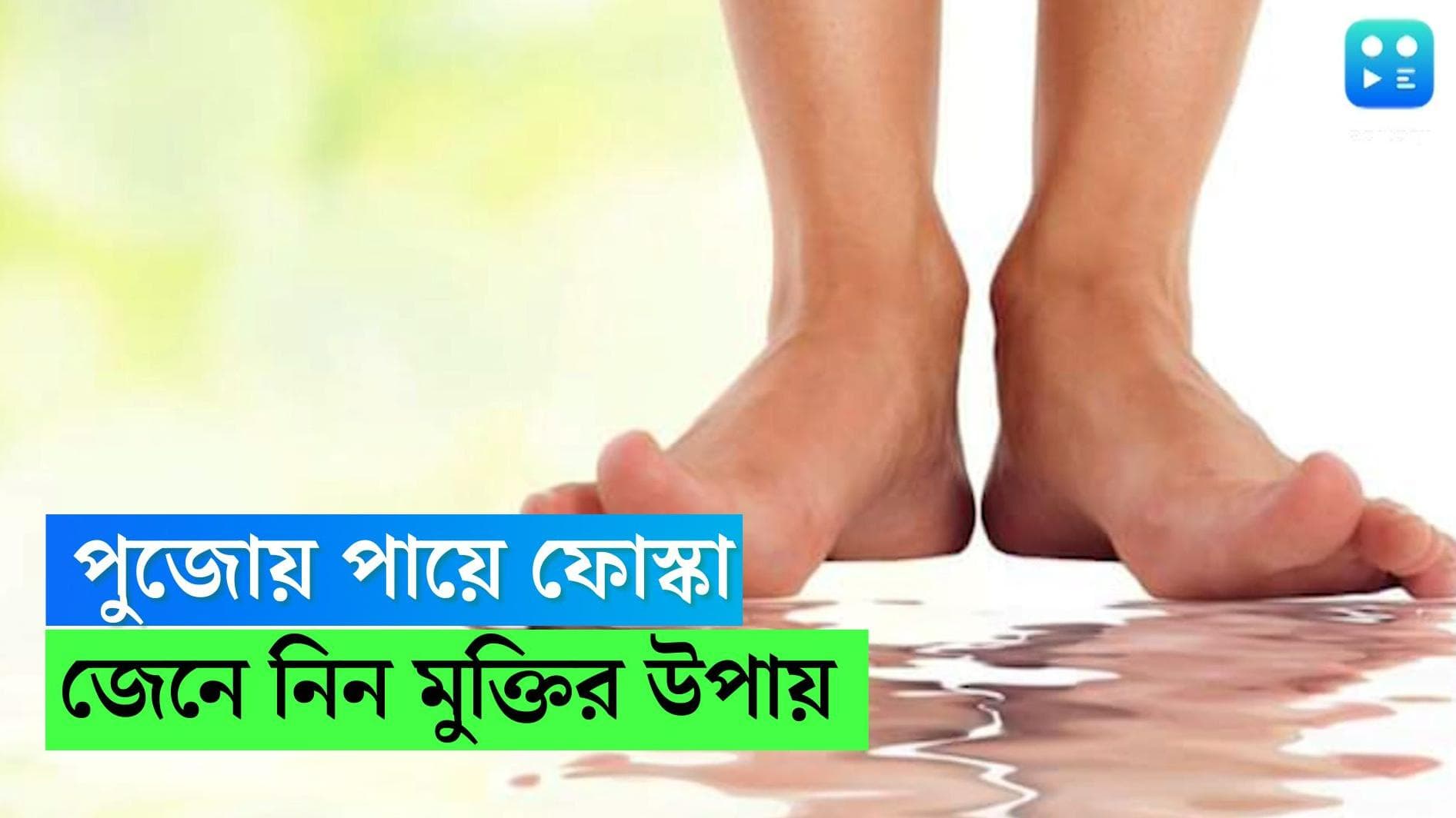 Foot bilster remedy: নতুর জুতোর সঙ্গেই পুজোয় ফ্রি গিফট ইয়া বড় ফোস্কা...মুশকিল আসান আছে কিছু?