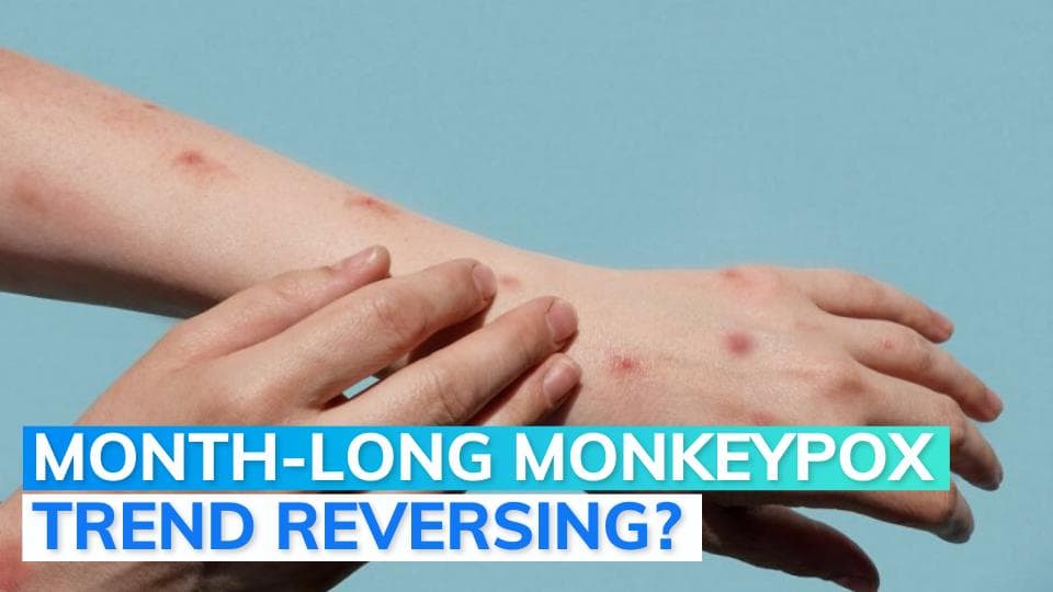 Monkeypox: WHO's good news announcement as cases drop 21%; warning for Americas