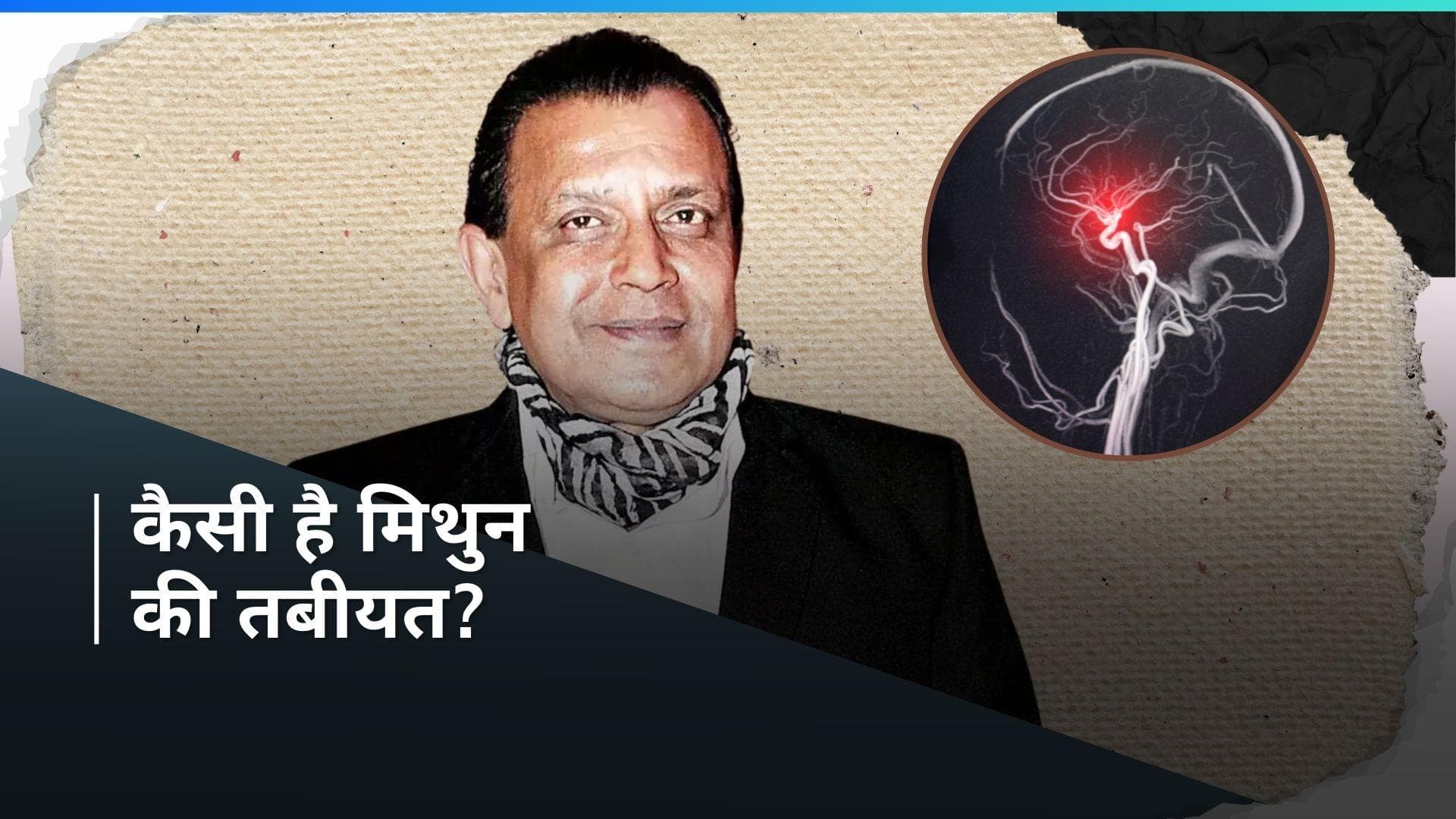 Mithun Chakraborty की हेल्थ अपडेट आई सामने, ब्रेन स्ट्रोक का चल रहा इलाज 