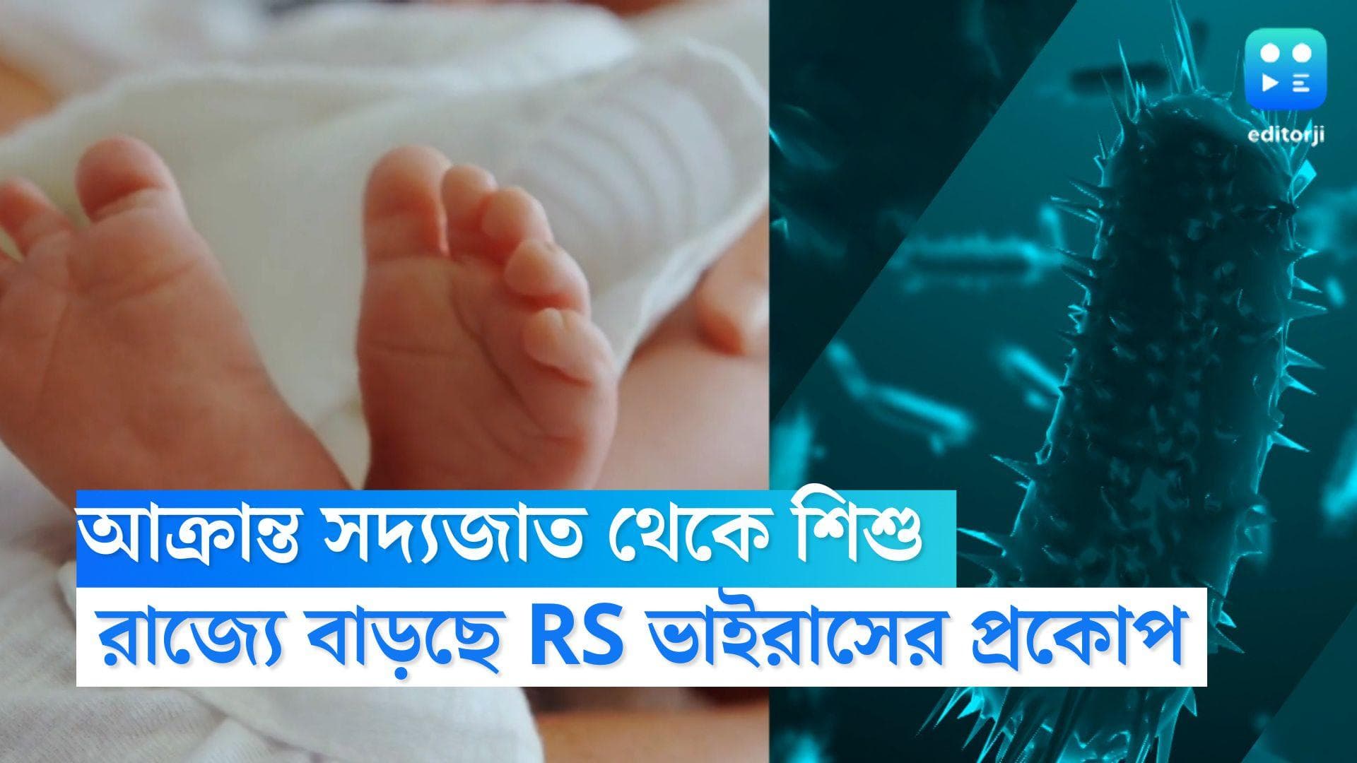 RS Virus in West Bengal: রাজ্যে বাড়ছে RS ভাইরাসের প্রকোপ, আক্রান্ত সদ্যজাত থেকে ২ বছরের শিশু