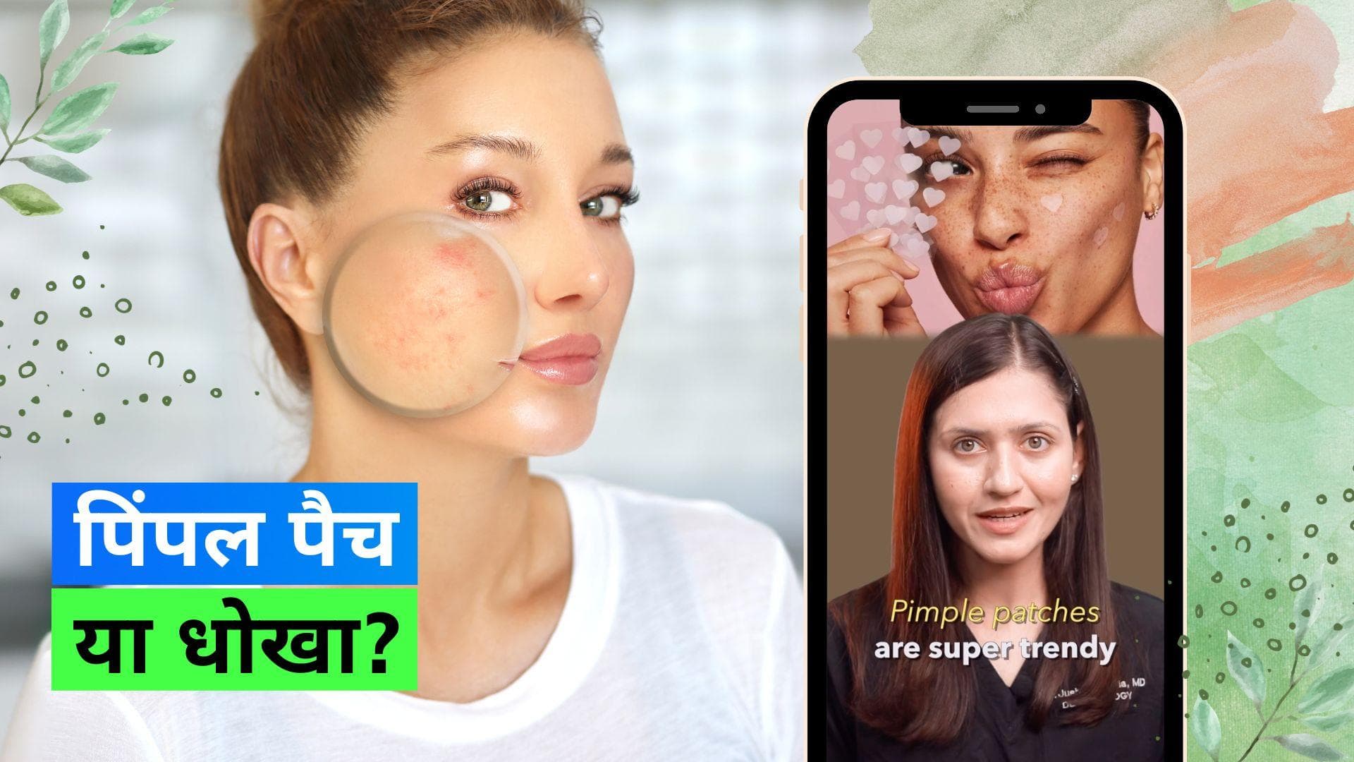 Pimple Patch: क्या पिंपल पैच करते हैं पिंपल को कम या है सिर्फ एक धोखा? स्किन एक्सपर्ट से जान लीजिये सच 