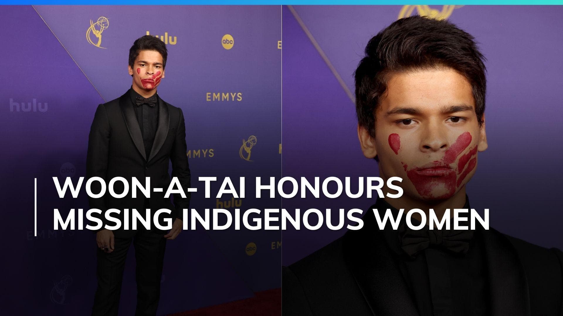 'Reservation Dogs' star D’Pharaoh Woon-A-Tai delivers symbolic message at Emmys with a red hand on face