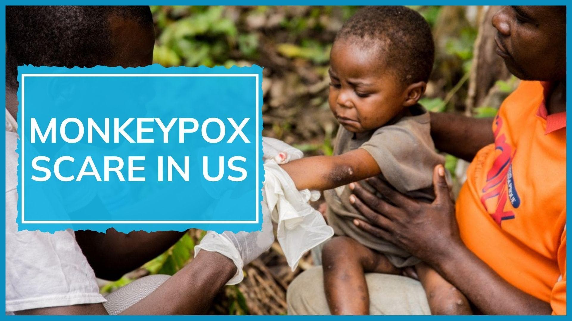 US confirms monkeypox infection in man who travelled to Canada