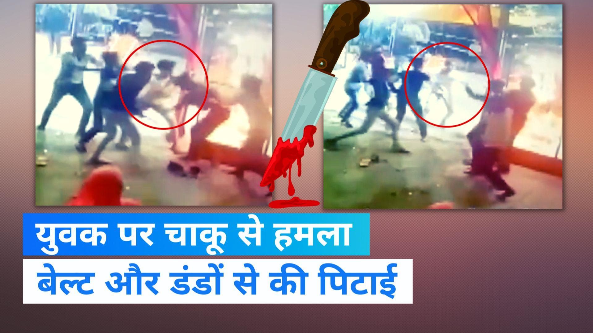 Indore: बदमाशों ने युवक पर चाकू से किया ताबड़तोड़ हमला, CCTV फुटेज आया सामने