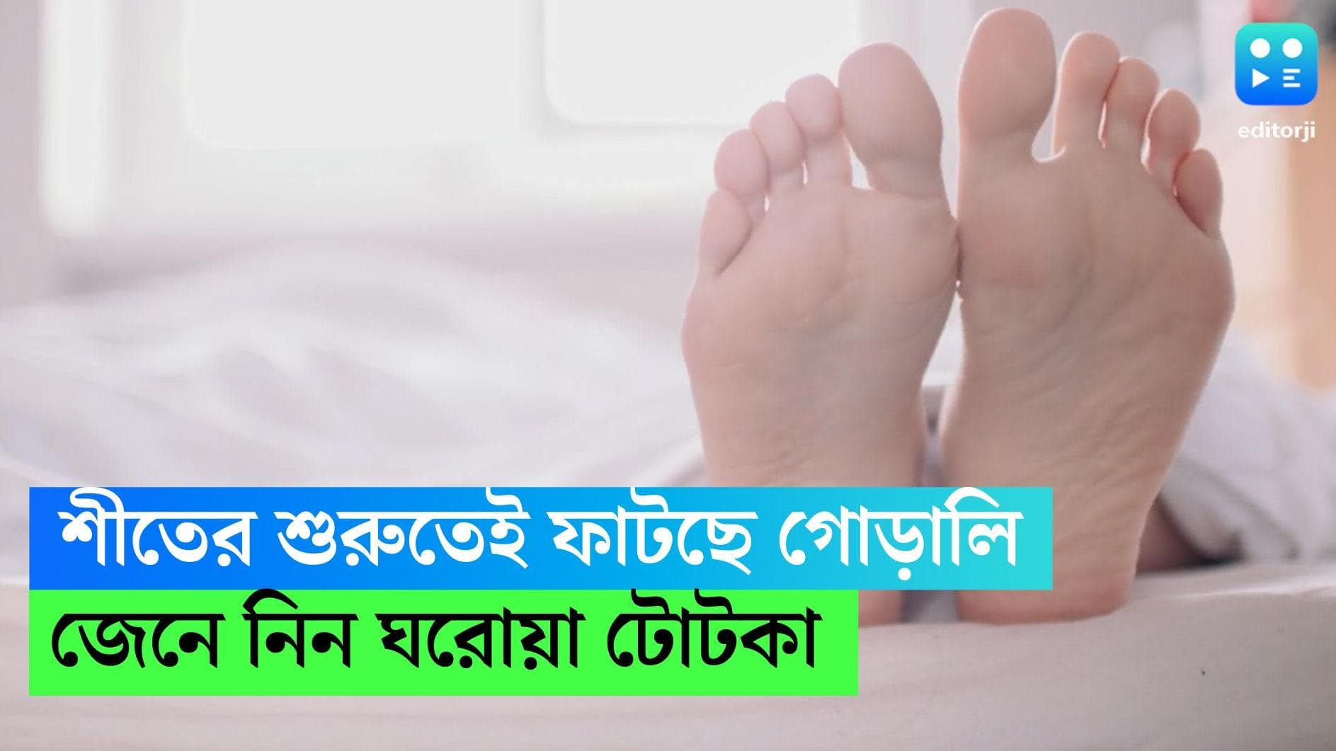 Winter Cracked Heel:শীতের শুরুতেই ফাটছে গোড়ালি? ঘরোয়া পদ্ধতিতে সমস্যা থেকে মুক্তি পেতে কী করবেন,জেনে নিন