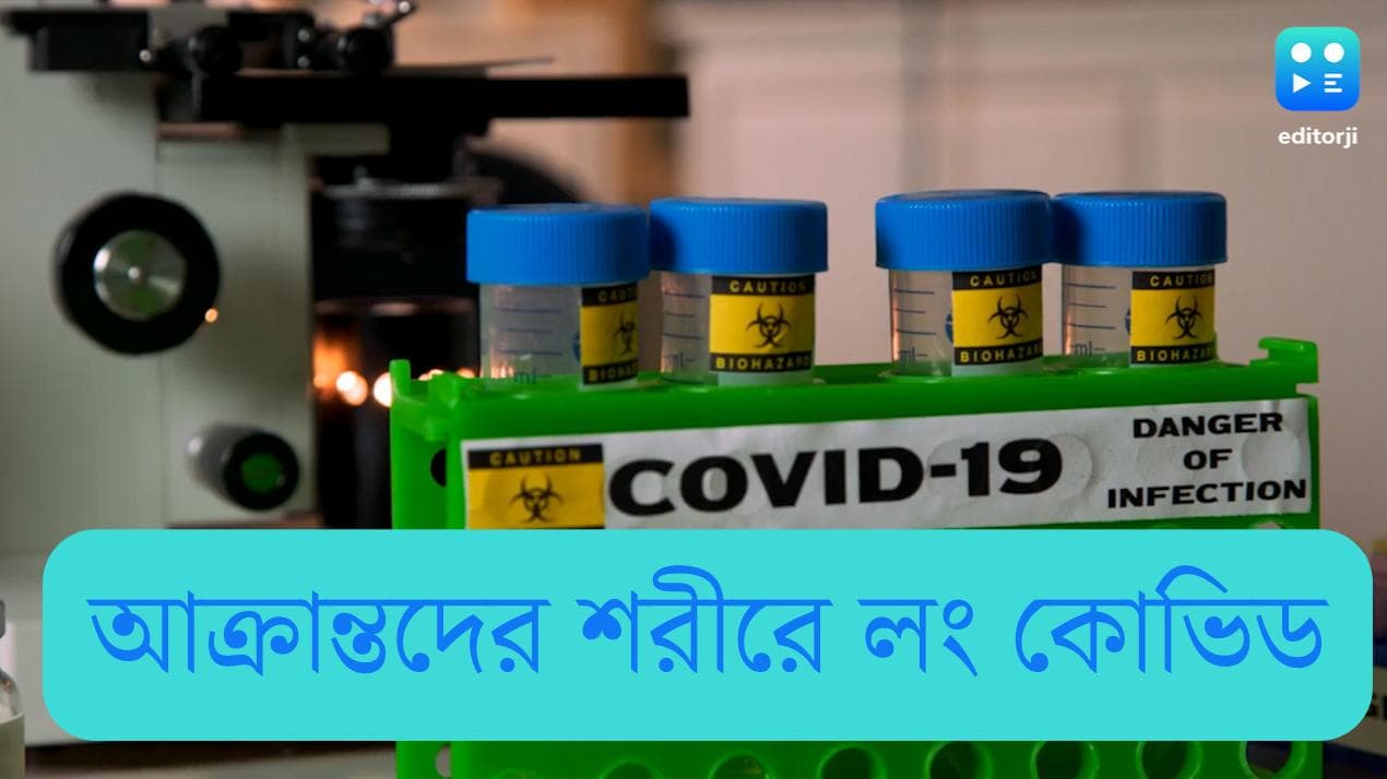 Long Covid: কোভিডে আক্রান্ত রোগীদের ৩০ শতাংশের শরীরে তৈরি হচ্ছে 'লং কোভিড', জানাচ্ছে গবেষণা