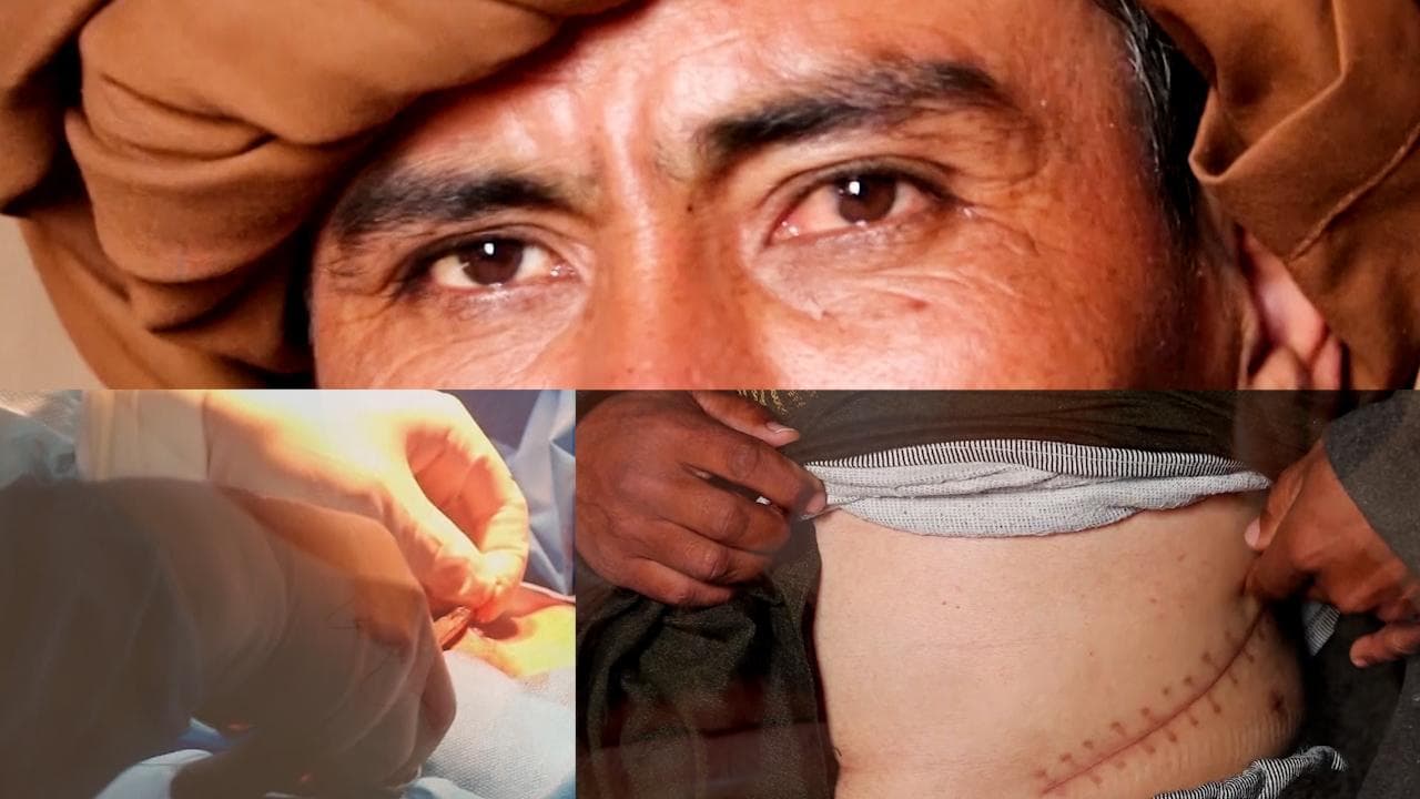 Ground Report ｜Extreme poverty drives some Afghans to sell organs