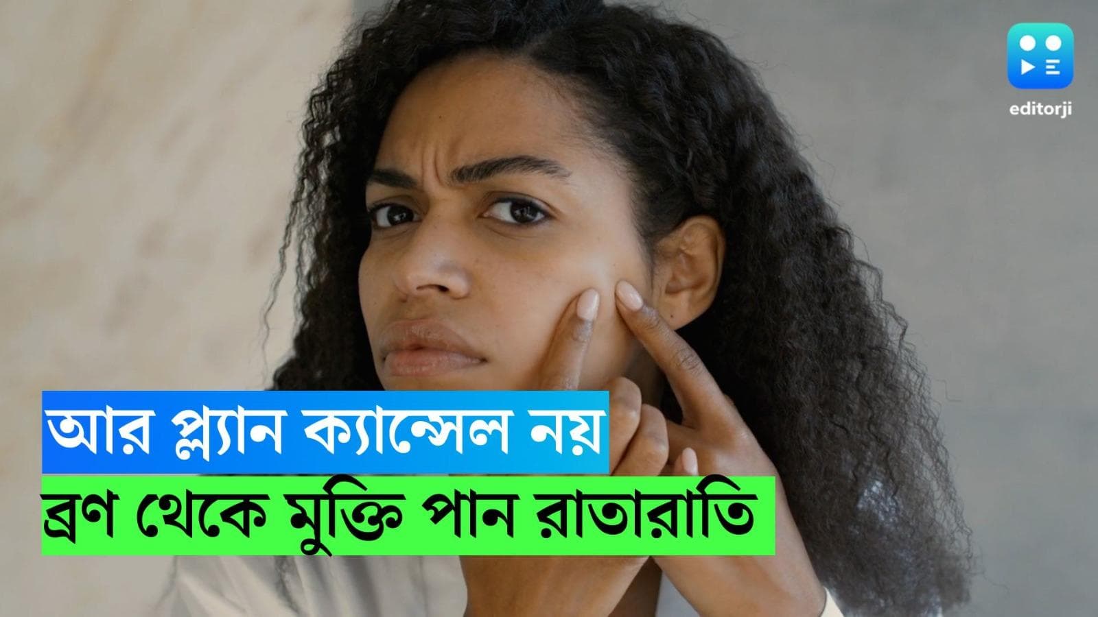Pimple Care: আর প্ল্যান ক্যান্সেল নয়! জানুন ব্রণ থেকে রাতারাতি মুক্তি পাওয়ার উপায়