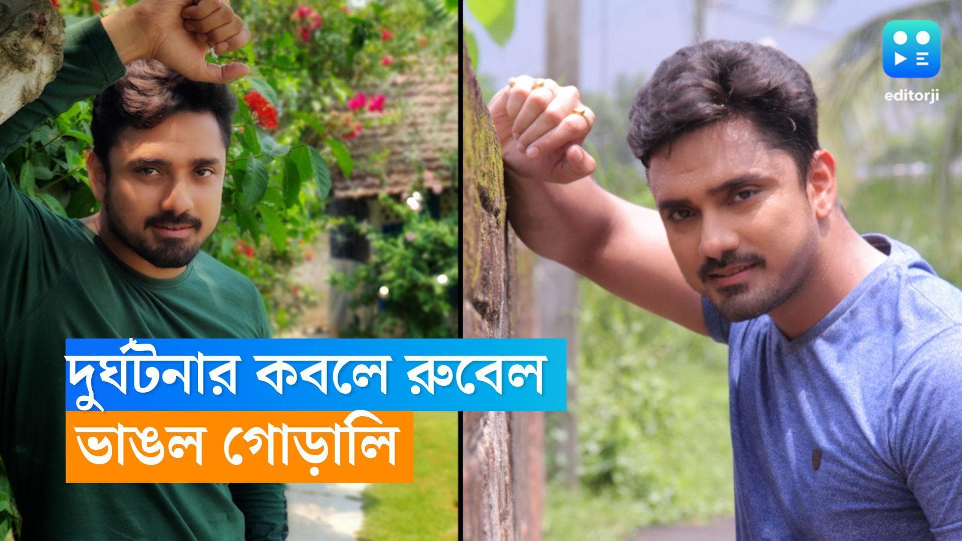 Rubel Das Accident: দুর্ঘটনায় জখম ‘নিম ফুলের মধু-র রুবেল, ভেঙে গিয়েছে দুই গোড়ালি 