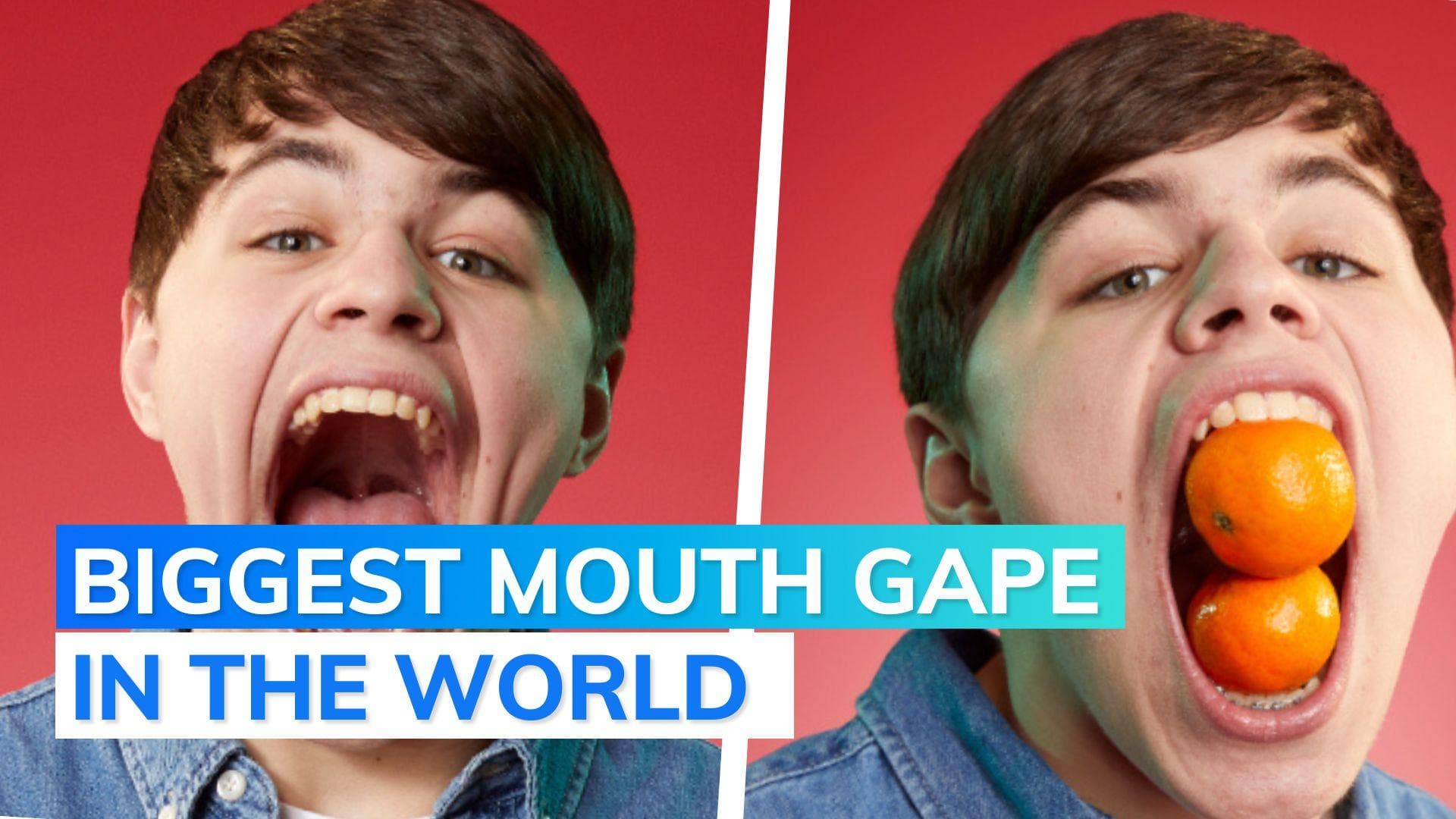 US teen breaks his own Guinness World Record, can fit 4 burgers in mouth
