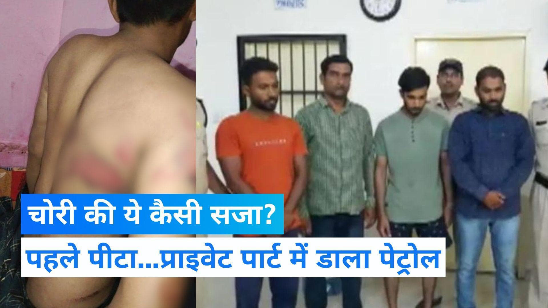 Madhya Pradesh: चोरी के शक में किराएदार को बंधक बना पीटा, प्राइवेट पार्ट में डाला पेट्रोल