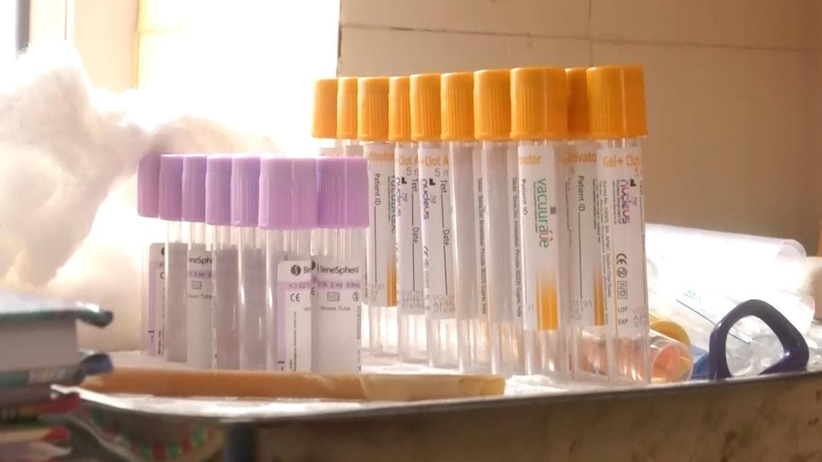 यूपी पहुंचा Omicron का खतरा: नोएडा में विदेश से आए 5 लोग पॉजिटिव, मुरादाबाद में 130 लापता