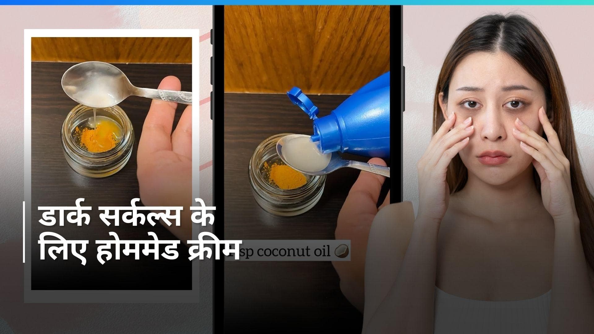 Dark Circles: डार्क सर्कल्स को हल्का करने के लिए ये होममेड क्रीम आएगी काम, जानें बनाने का तरीका