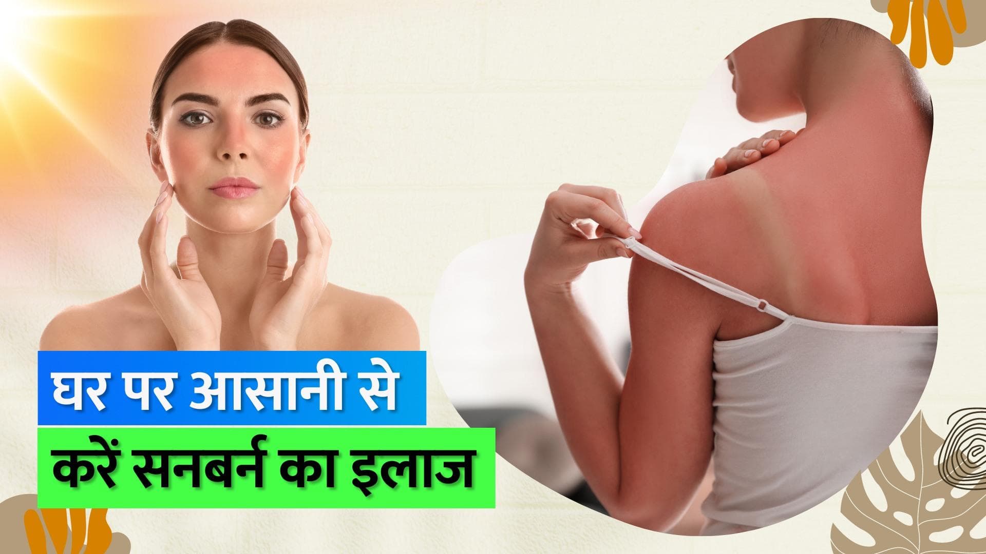 Sunburn Remedy: गर्मियों के मौसम में सनबर्न और रैश ठीक कर सकती हैं 5 चीज़ें, जानिए कैसे करना है इस्तेमाल