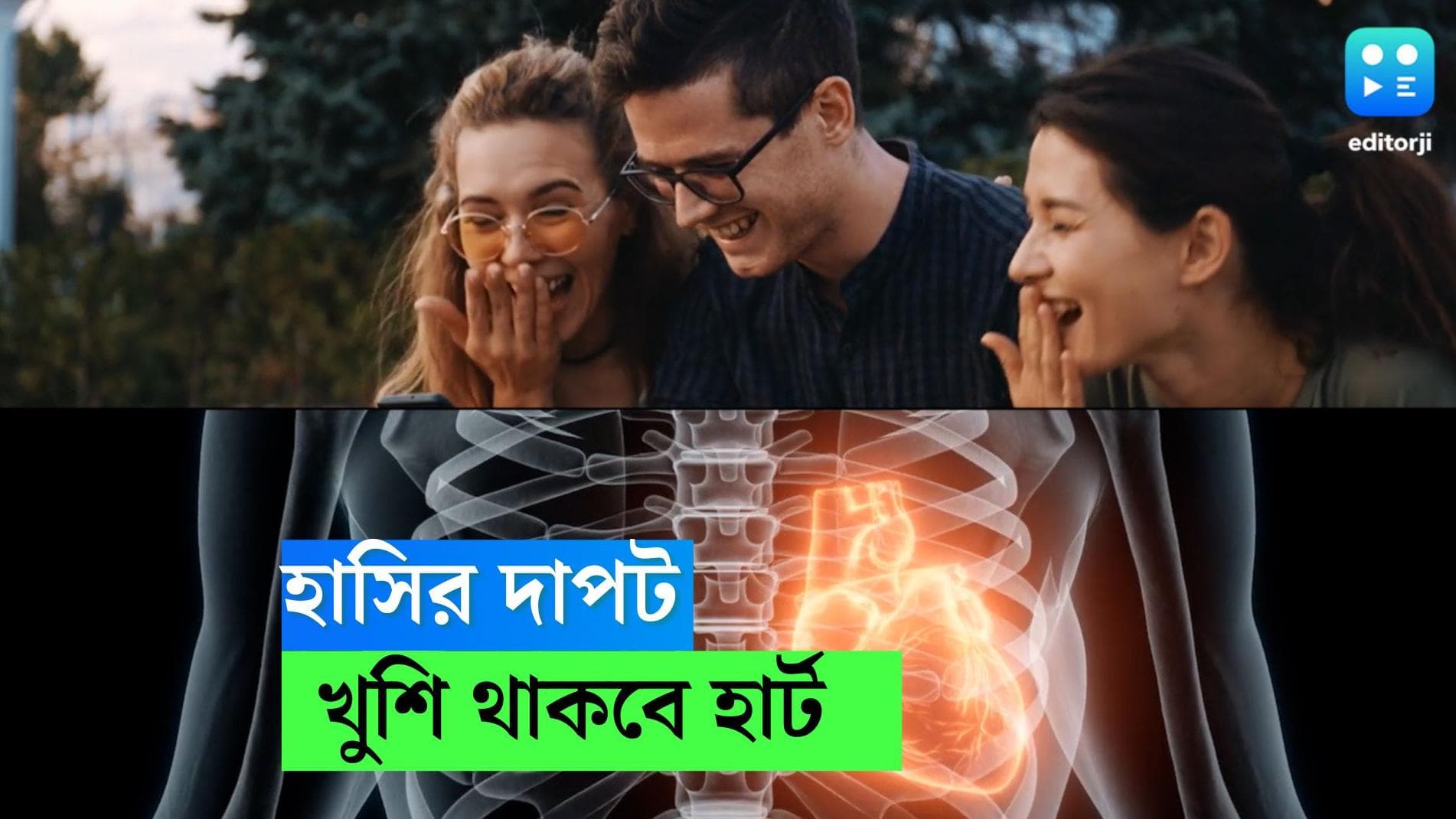 Laughter Therapy:হাসলেই খুশি হার্ট, কমবে ওষুধের প্রয়োজন, বলছেন বিজ্ঞানীরা