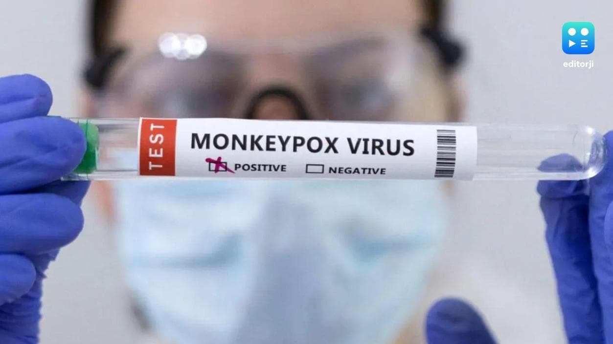 Two Monkeypox cases reported in Kerala