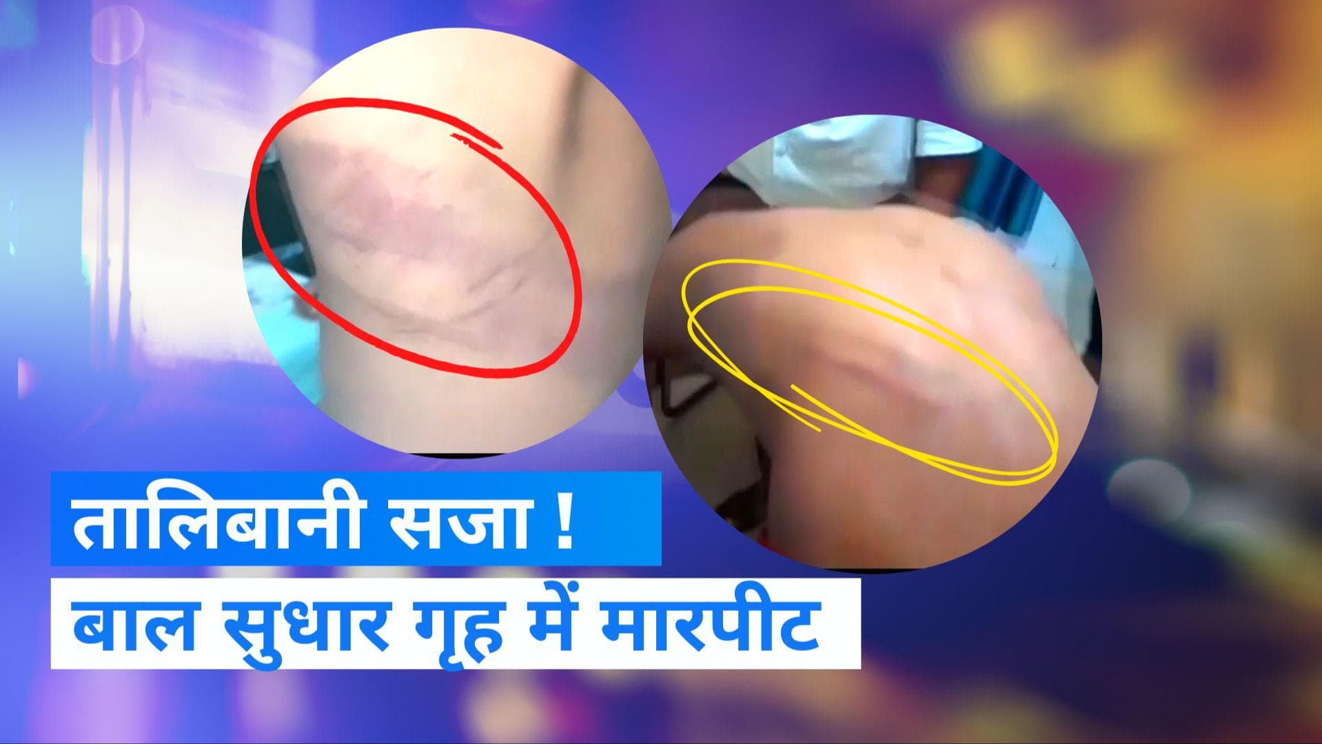 Mathura: बाल सुधार गृह में बर्बरता, कर्मचारियों की 'तालिबानी सजा' पर प्रोबेशन अधिकारी की सफाई