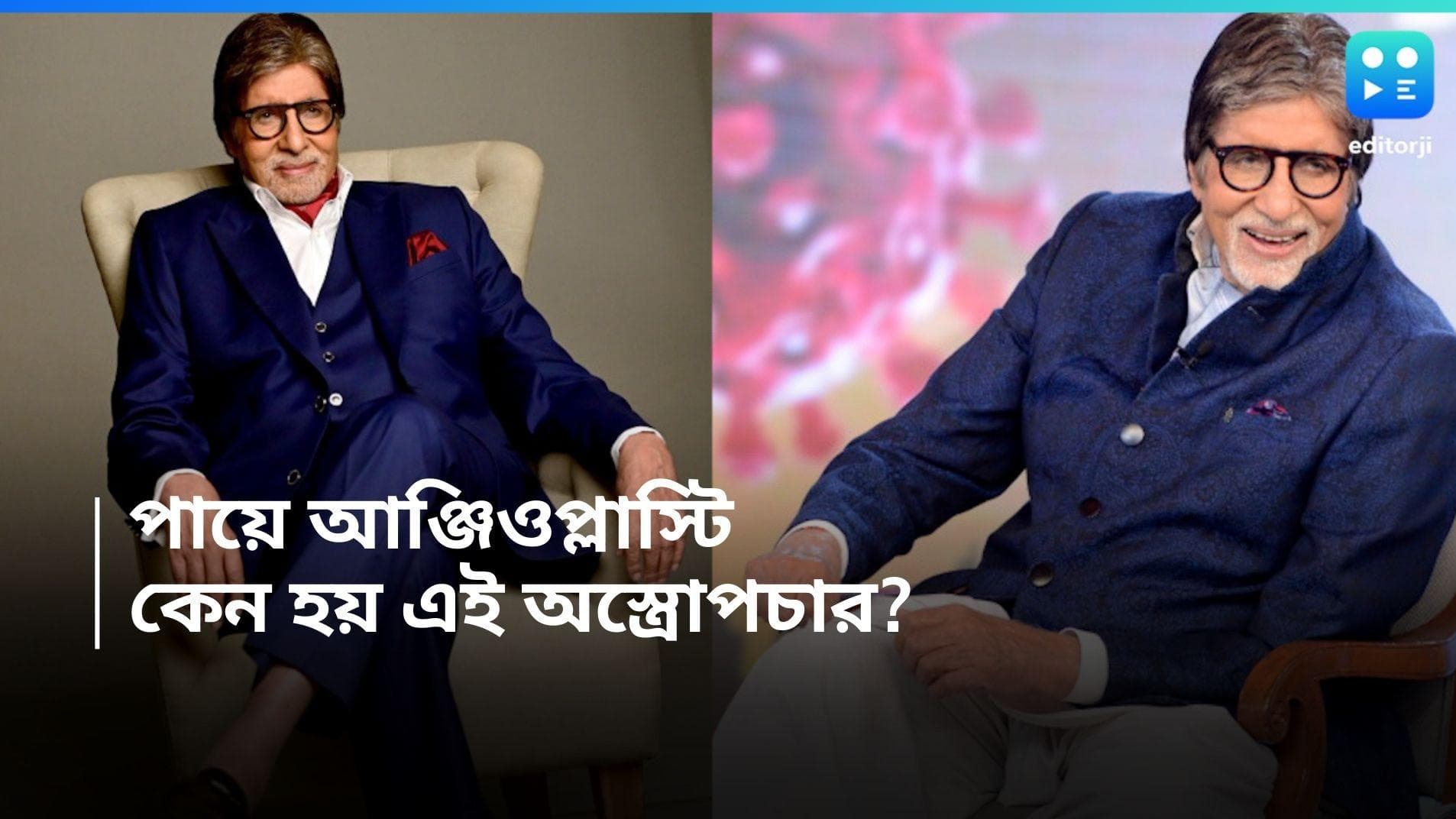Amitabh Bachchan :  শাহেনশা অমিতাভ বচ্চনের পায়ে আঞ্জিওপ্লাস্টি! কেন করা হয় এই চিকিৎসা? 