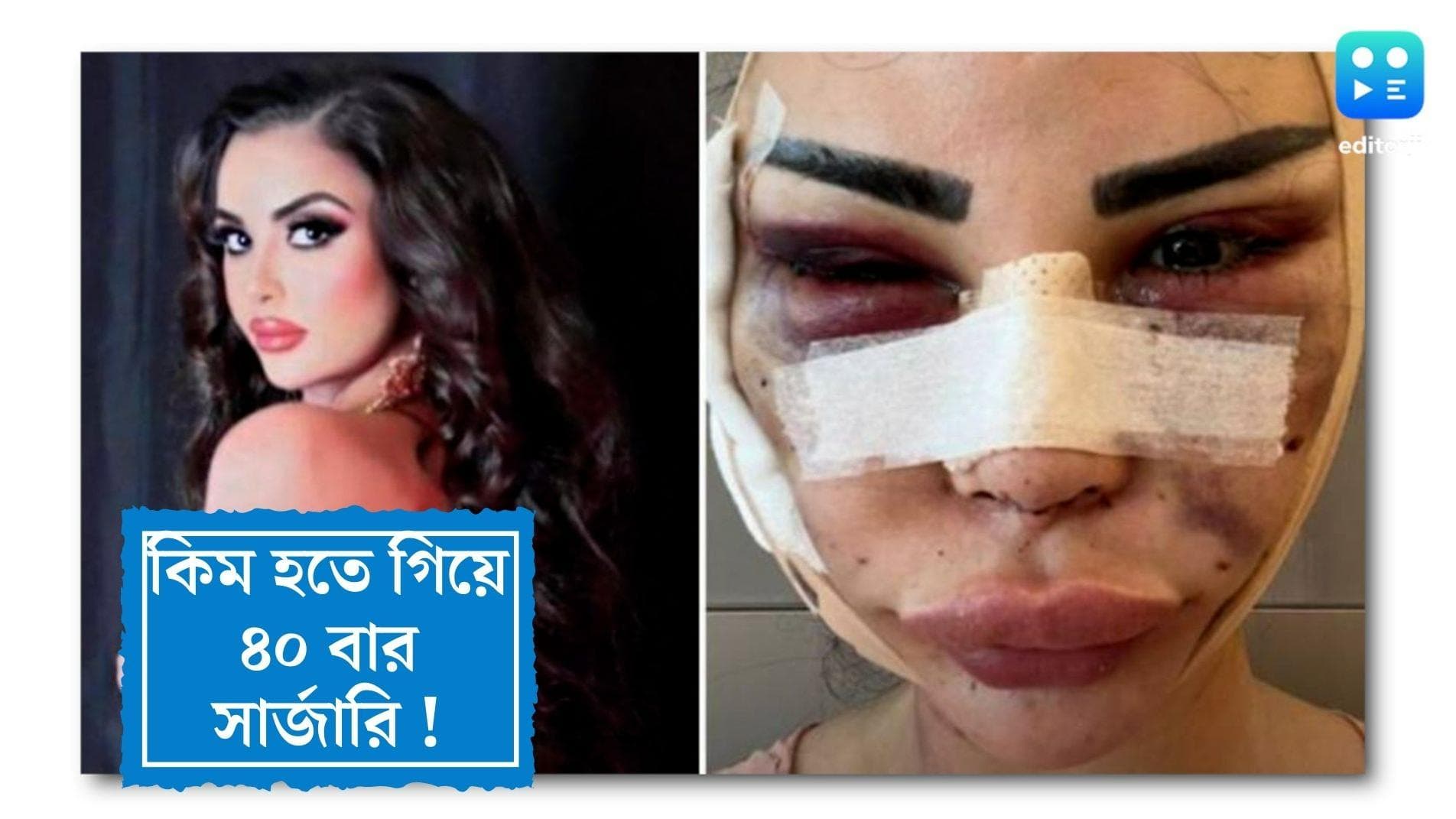 Jennifer Pamplona : কিম কার্দাশিয়ান হতে গিয়ে ৪০ বার সার্জারি, আবার পুরনো চেহারায় ফিরতে চাইছেন এই মডেল