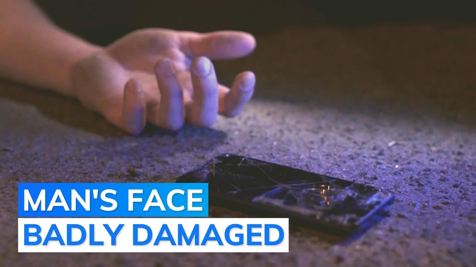 Suspected mobile battery explosion kills MP man: police