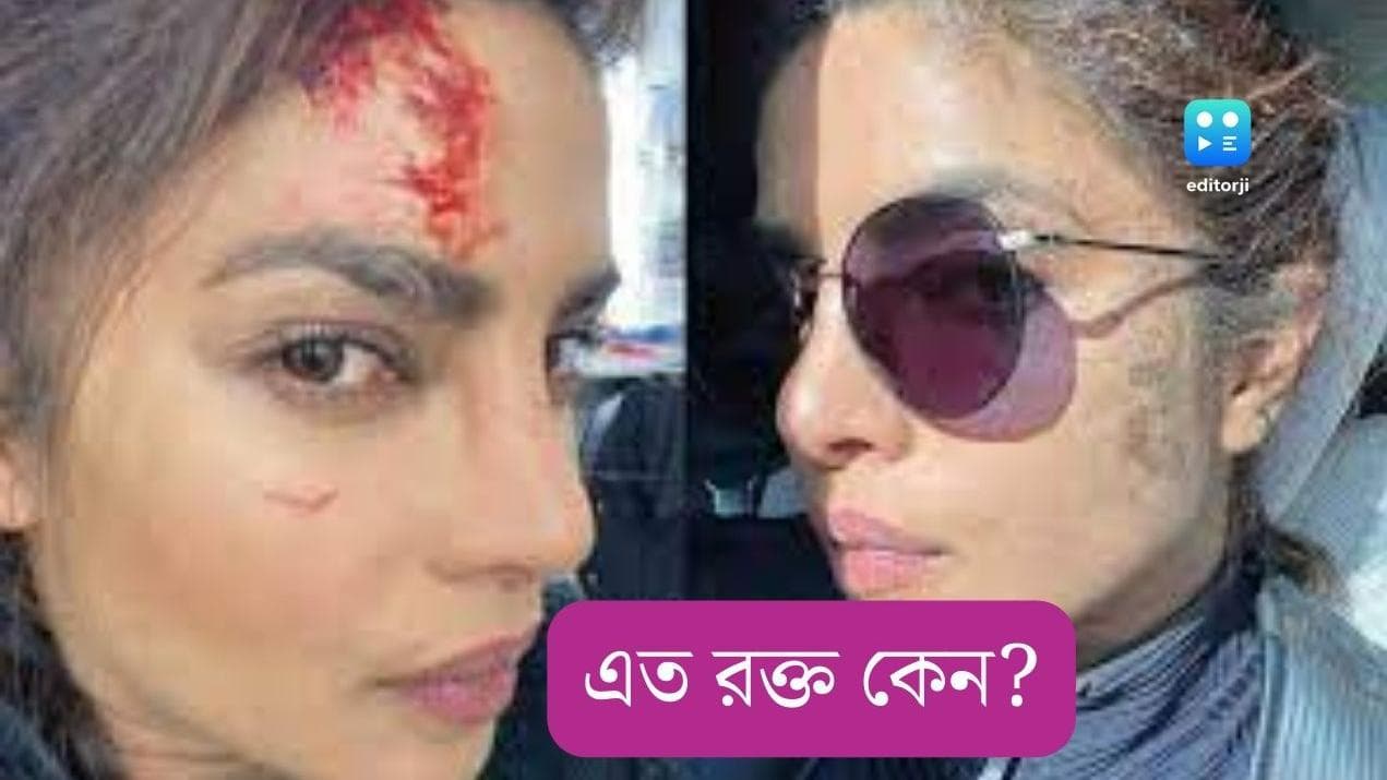 Priyanka Chopra:ছবিতে ‘রক্তাক্ত’, সত্যিই কি বিপদে প্রিয়াঙ্কা? 