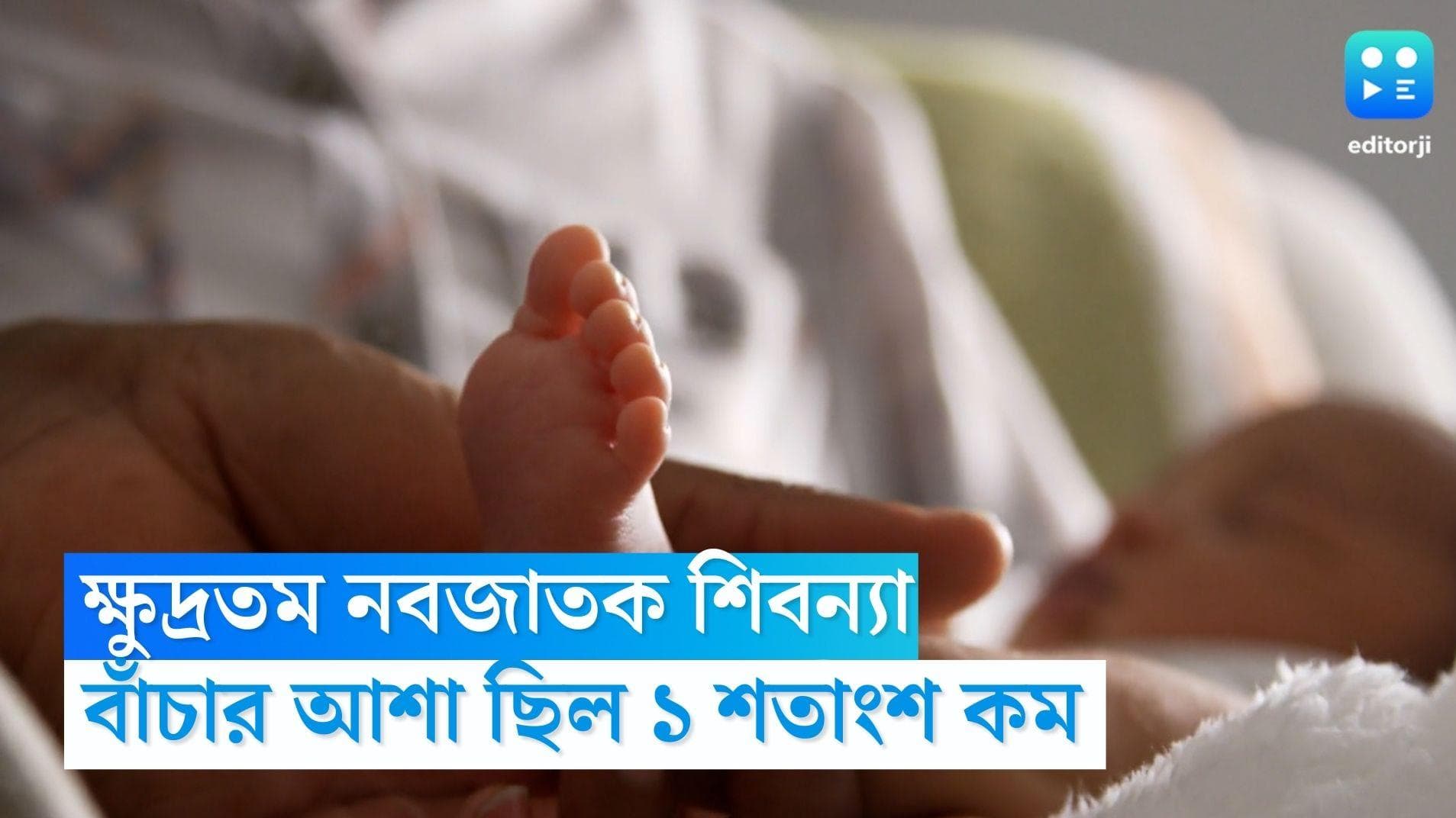 Smallest Child: দেশের ক্ষুদ্রতম নবজাতক, ওজন ৪০০ গ্রাম, বাঁচার আশা ছিল ১ শতাংশেরও কম