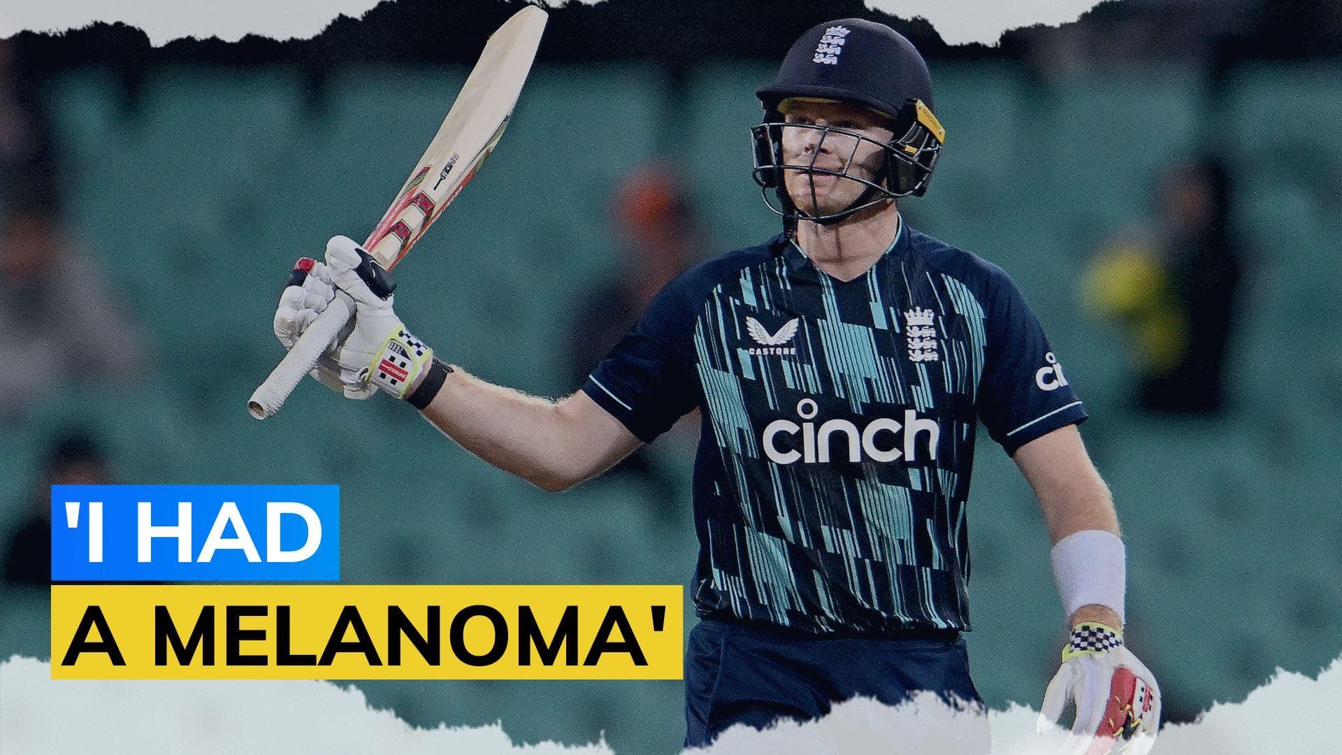 England cricketer Sam Billings opens up about his battle with skin cancer