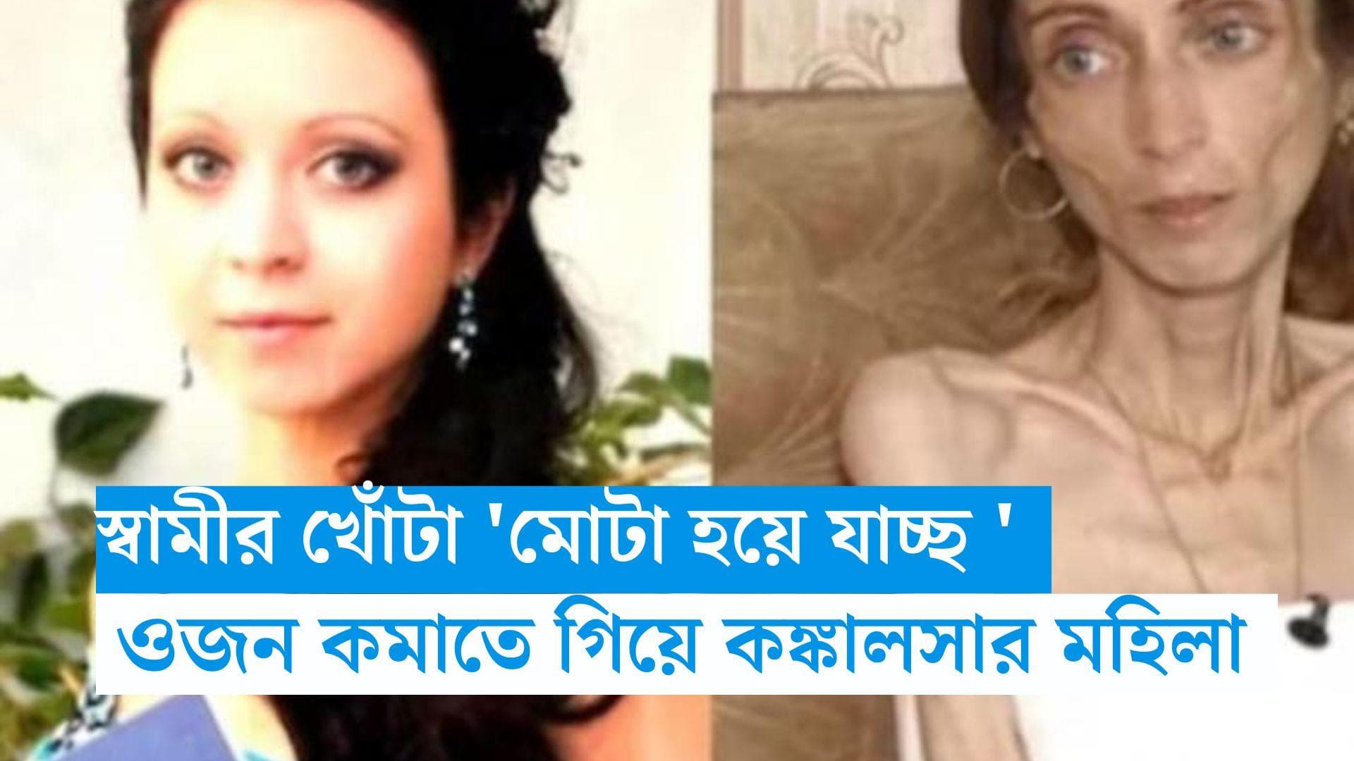 Fat to Slim: মোটা বলে 'খোঁটা' দিয়েছিলেন স্বামী, ওজন কমিয়ে ২২ কেজিতে 'কঙ্কালসার' রাশিয়ার মহিলা 