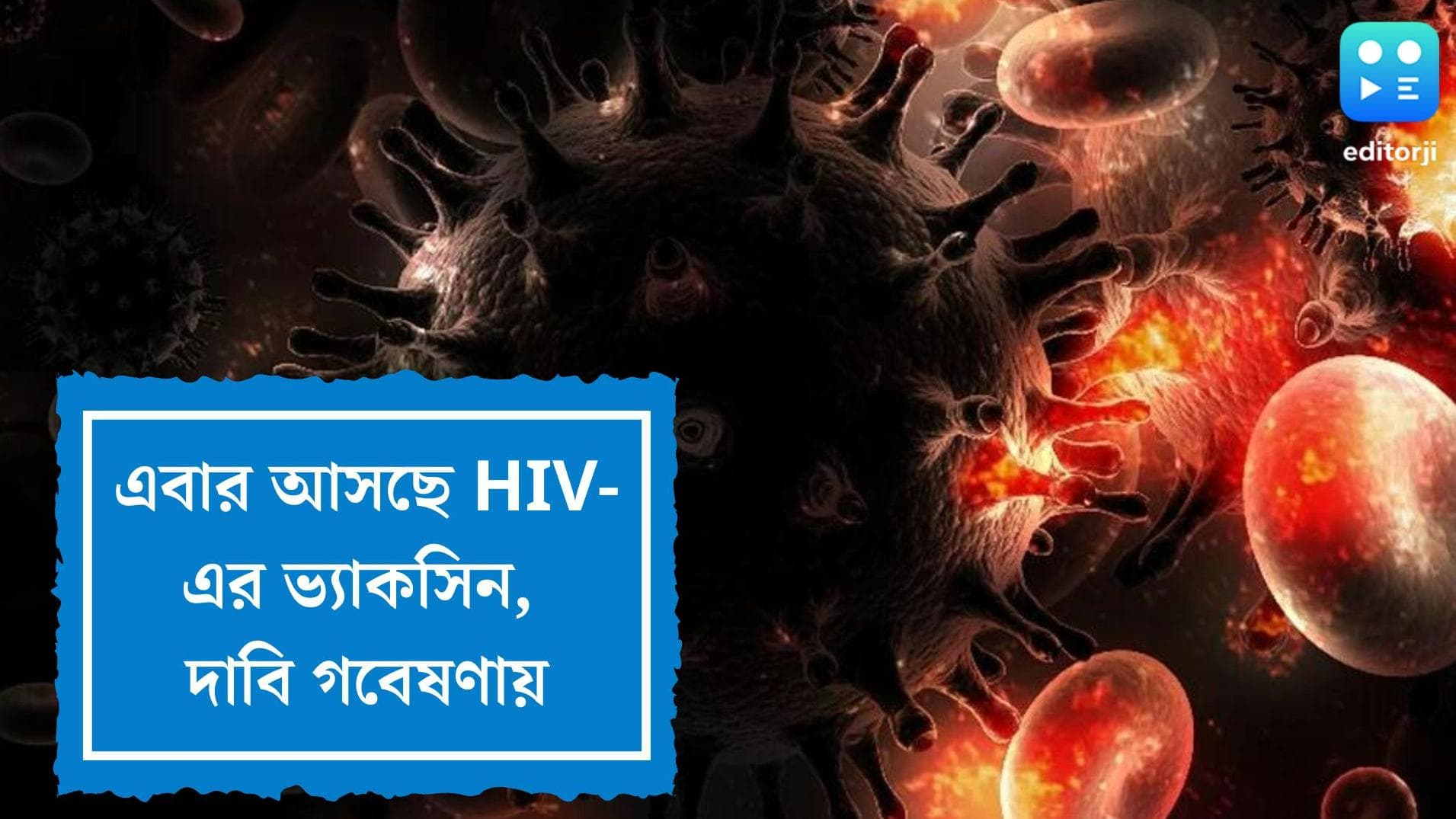 HIV-AIDS vaccine: এইচআইভি-এইডসের মোকাবিলার জন্য ভ্যাকসিন? দাবি তেল আভিভ বিশ্ববিদ্যালয়ের গবেষকদের
