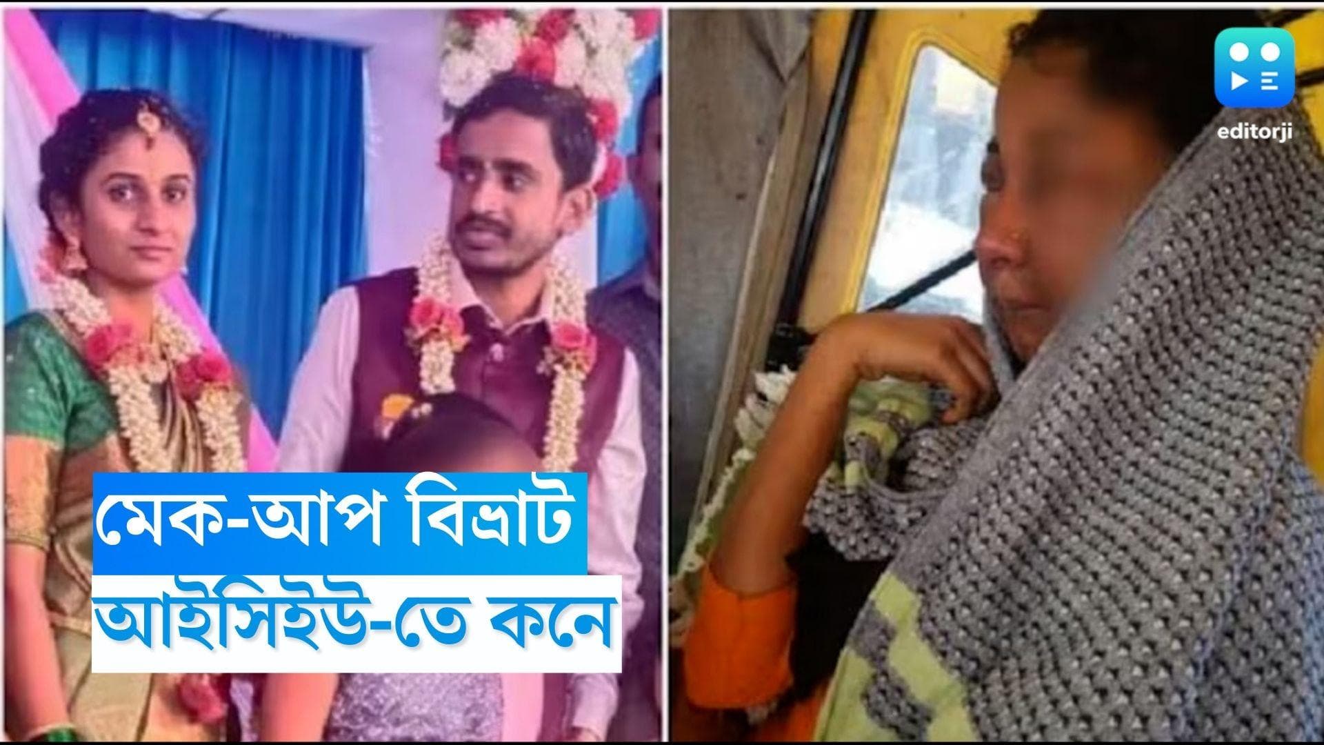 Karnataka Bride: ব্রাইডাল মেকআপে বিপত্তি, পুড়ে গেল মুখের চামড়া, আইসিইউতে ভর্তি কনে