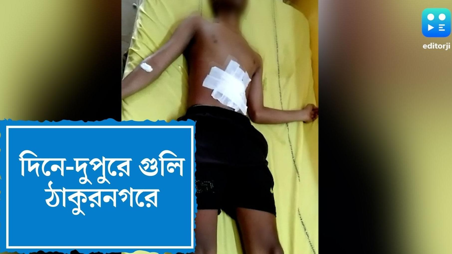 Shootout in Thakurnagar: ভরদুপুরে ঠাকুরনগরে শ্যুটআউট, গুলিবিদ্ধ এক, আতঙ্কে এলাকাবাসী