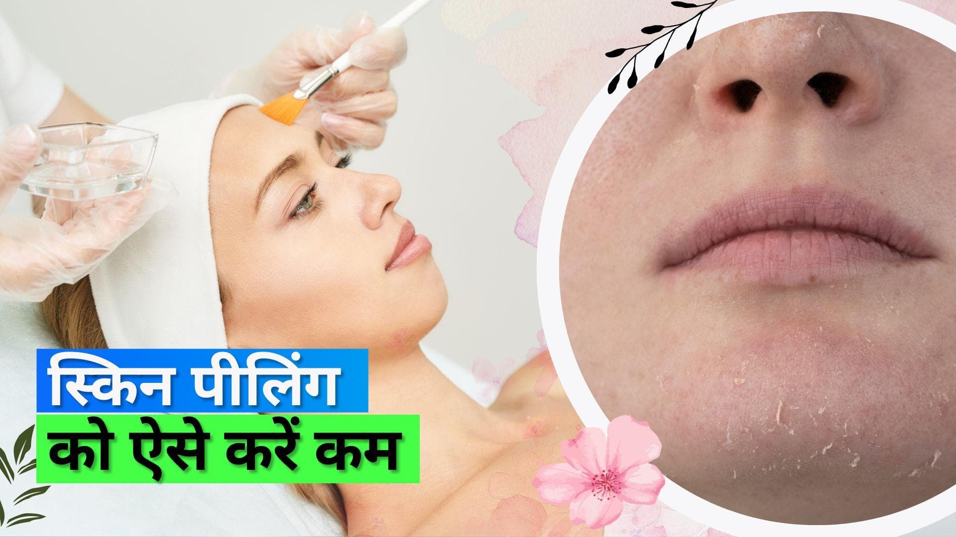 Skin Peeling: गर्मियों में स्किन पीलिंग से बचने के लिए टिप्स 