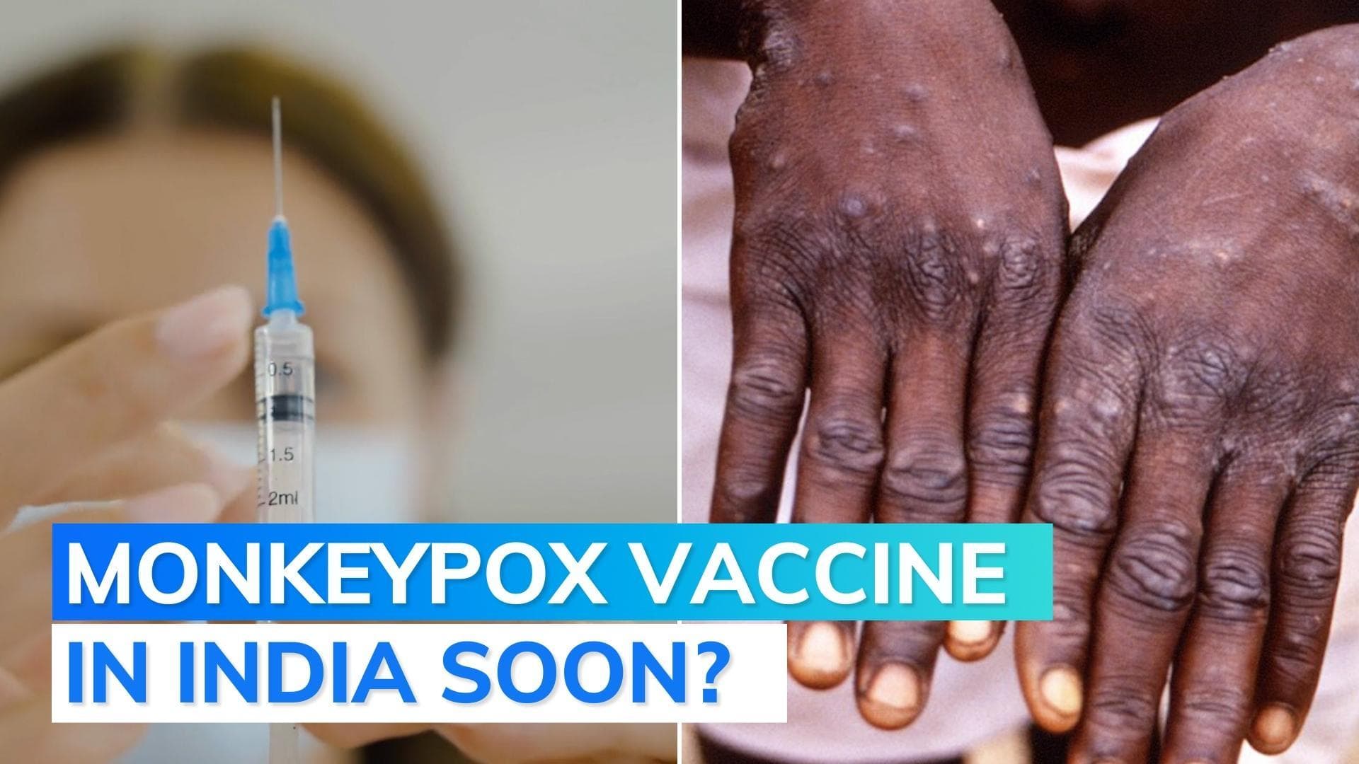 Serum Institute in talks with Danish firm to import monkeypox vaccine