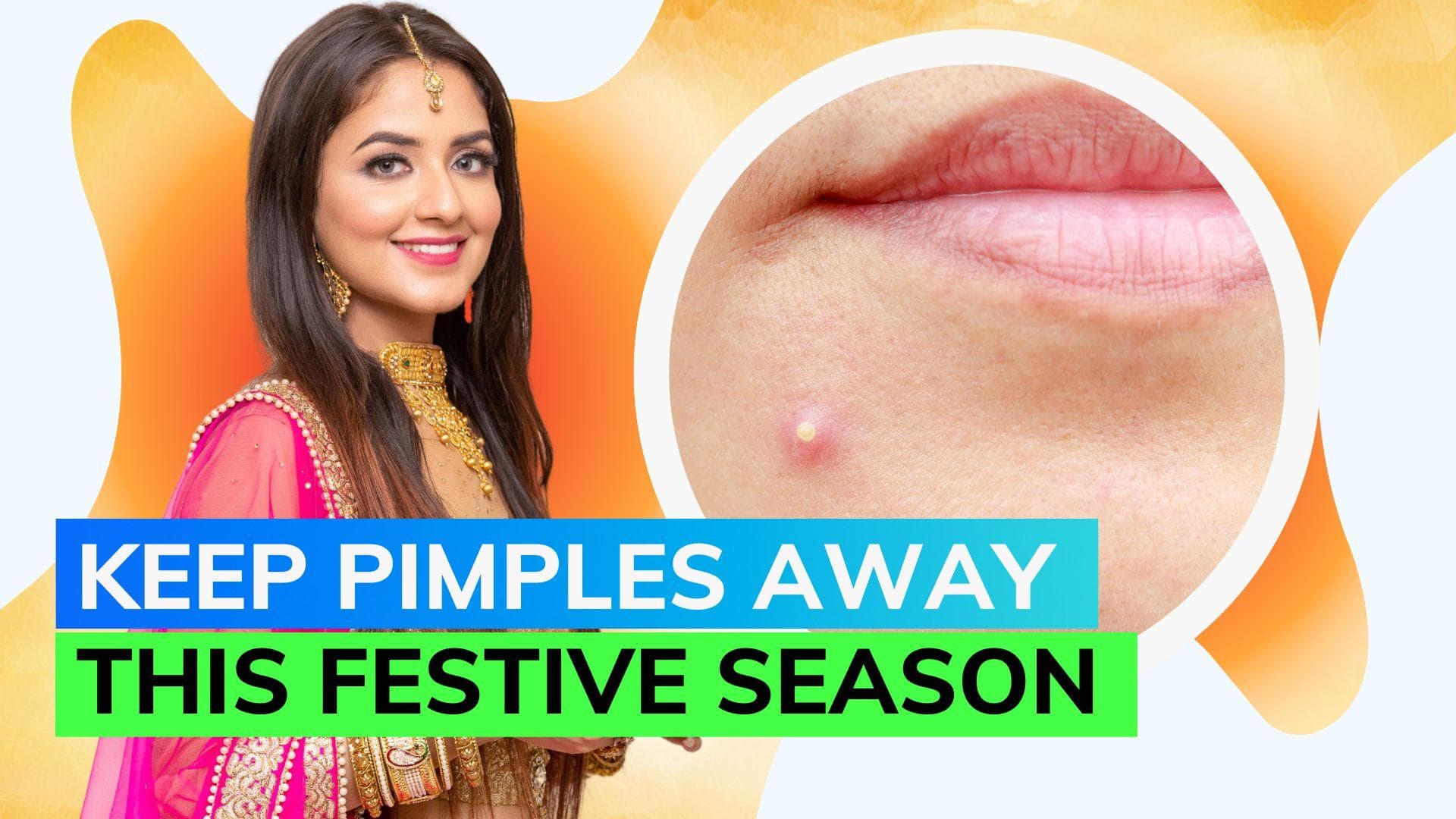 Festive skin SOS:  Expert tips for pimple-free celebrations