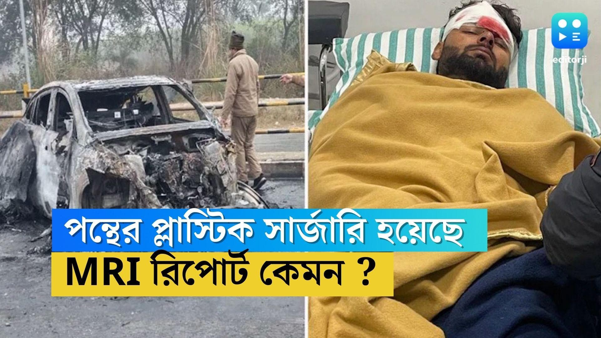 Rishabh Pant health Update : শুক্রবার রাতেই প্লাস্টির সার্জারি, এখন কেমন আছেন ঋষভ পন্থ ?