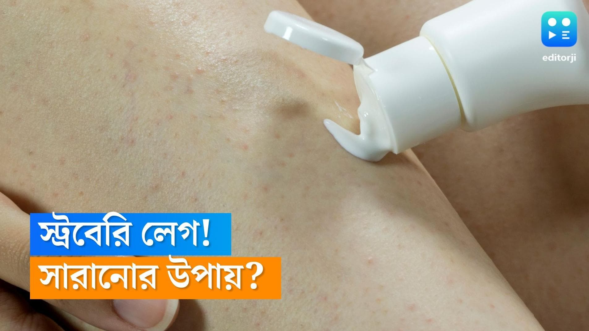 Durga Puja 2022 : 'স্ট্রবেরি লেগ' -এর সমস্যা রয়েছে ? পুজোর আগে সমাধান চান ? রইল টিপস