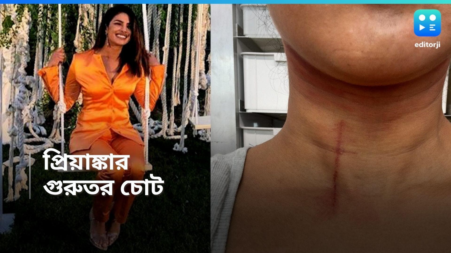 Priyanka Chopra: রক্তে ভেসে যাচ্ছে, গলা-বুক! গুরুতর আহত প্রিয়াঙ্কা চোপড়া, কী হয়েছে অভিনেত্রীর? 