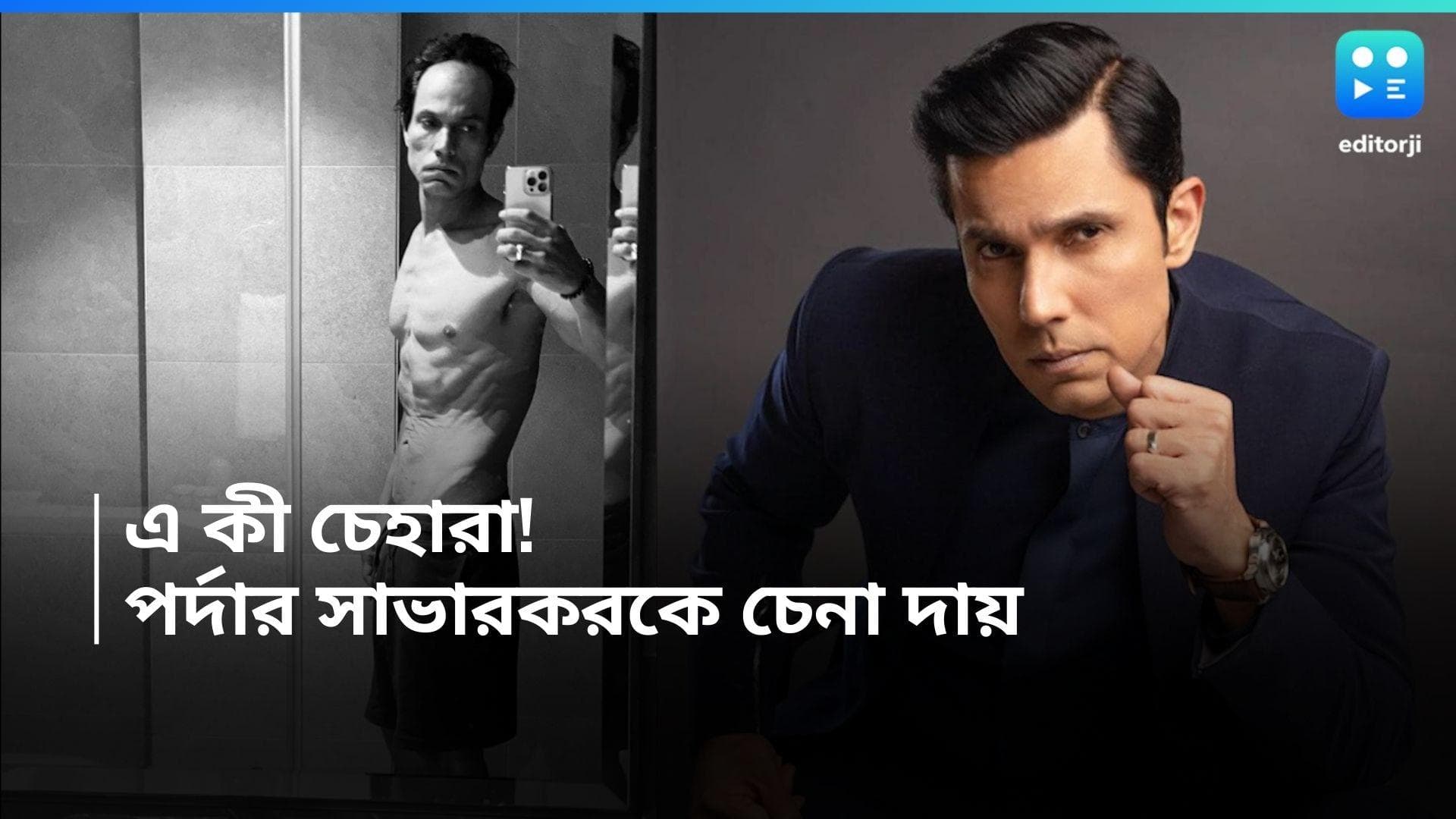 Randeep Hooda : মাথার সামনে টাক, কঙ্কালসার চেহারা, এ কী হাল রণদীপ হুডার ! বড় রোগে ভুগছেন অভিনেতা ?