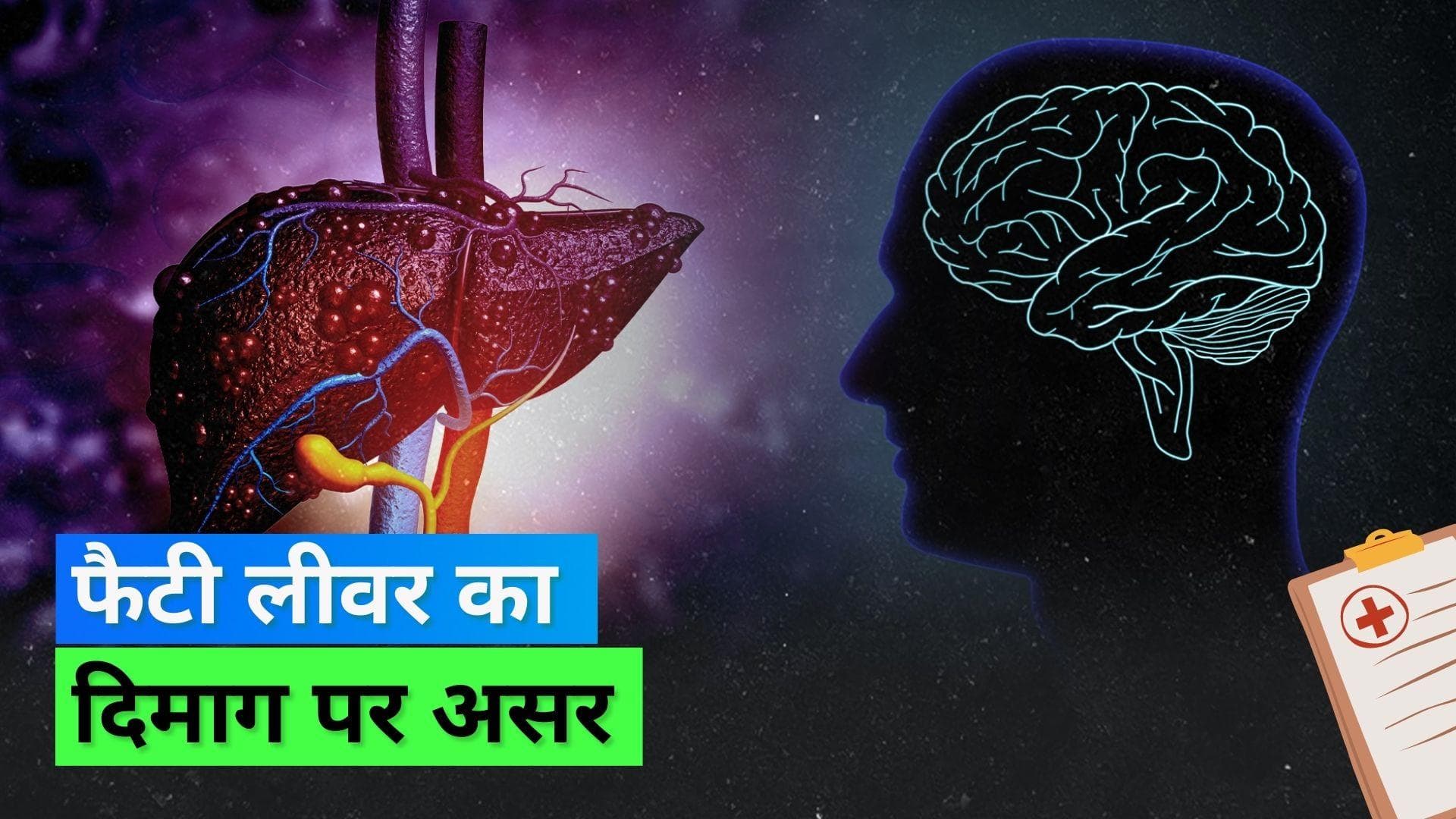 Fatty Liver: फैटी लीवर की वजह से दिमाग पर पड़ सकता है असर, जानिए क्या कहती है स्टडी
