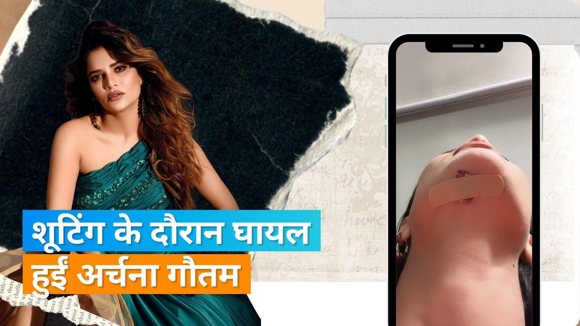 Khatron Ke Khiladi 13 की शूटिंग के दौरान घायल हुईं Archana Gautam  ठुड्डी के नीचे लगे तीन टांके 