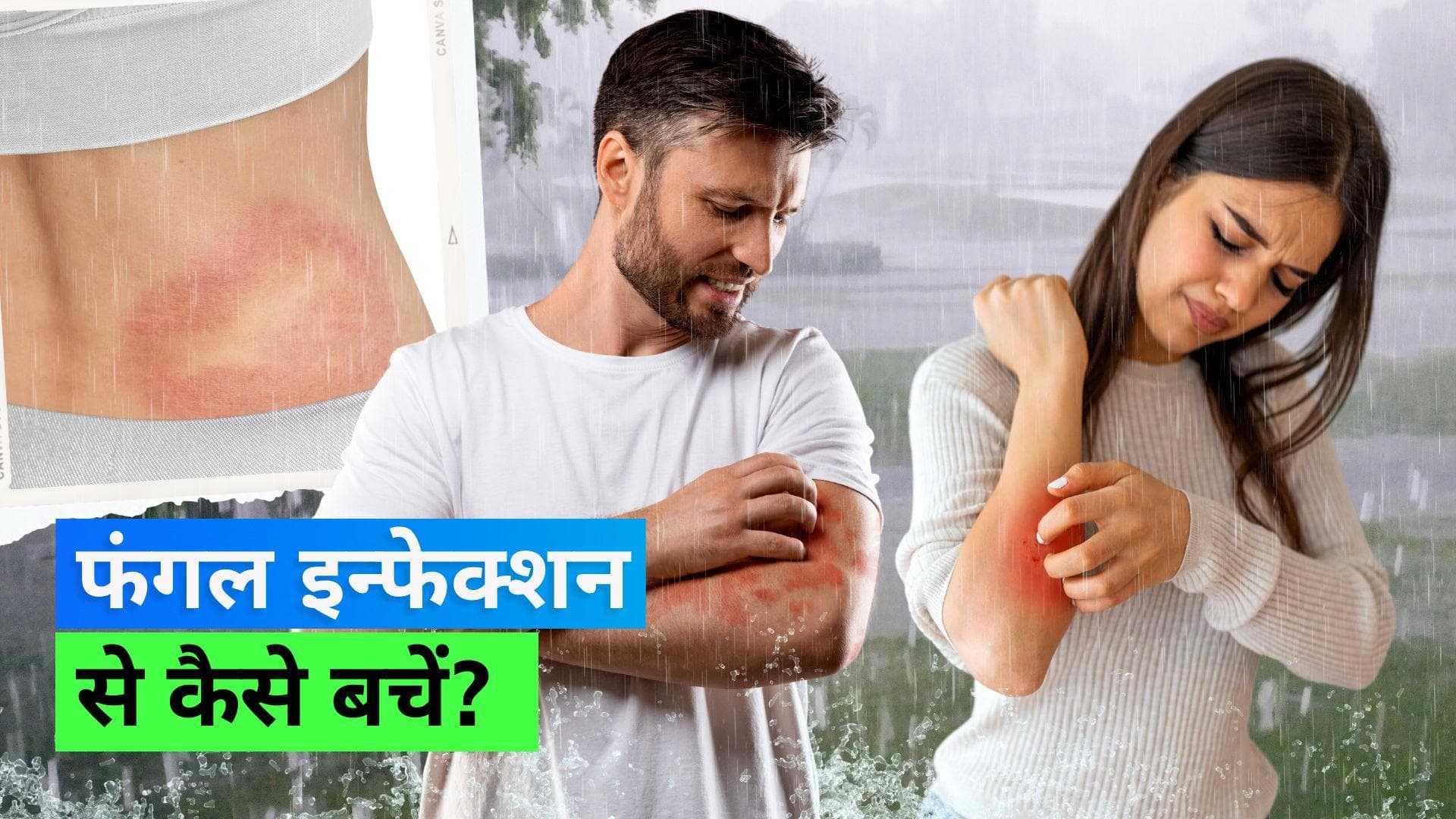 Monsoon 2023: बारिश के मौसम में हो जाती है फंगल इन्फेक्शन की समस्या तो अपनाएं ये 6 टिप्स