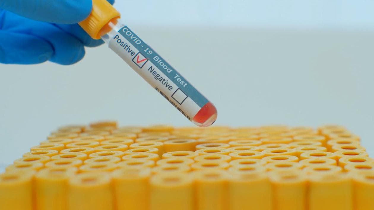 Lalbazar: লালবাজারে করোনা হানা, আক্রান্ত ৭ আইপিএস অফিসার সহ মোট ৮০ পুলিশকর্মী