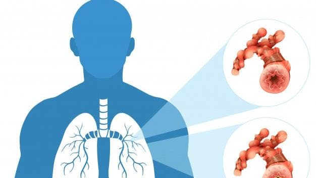 Traces of blood in your mucus may be a sign of Acute Bronchitis